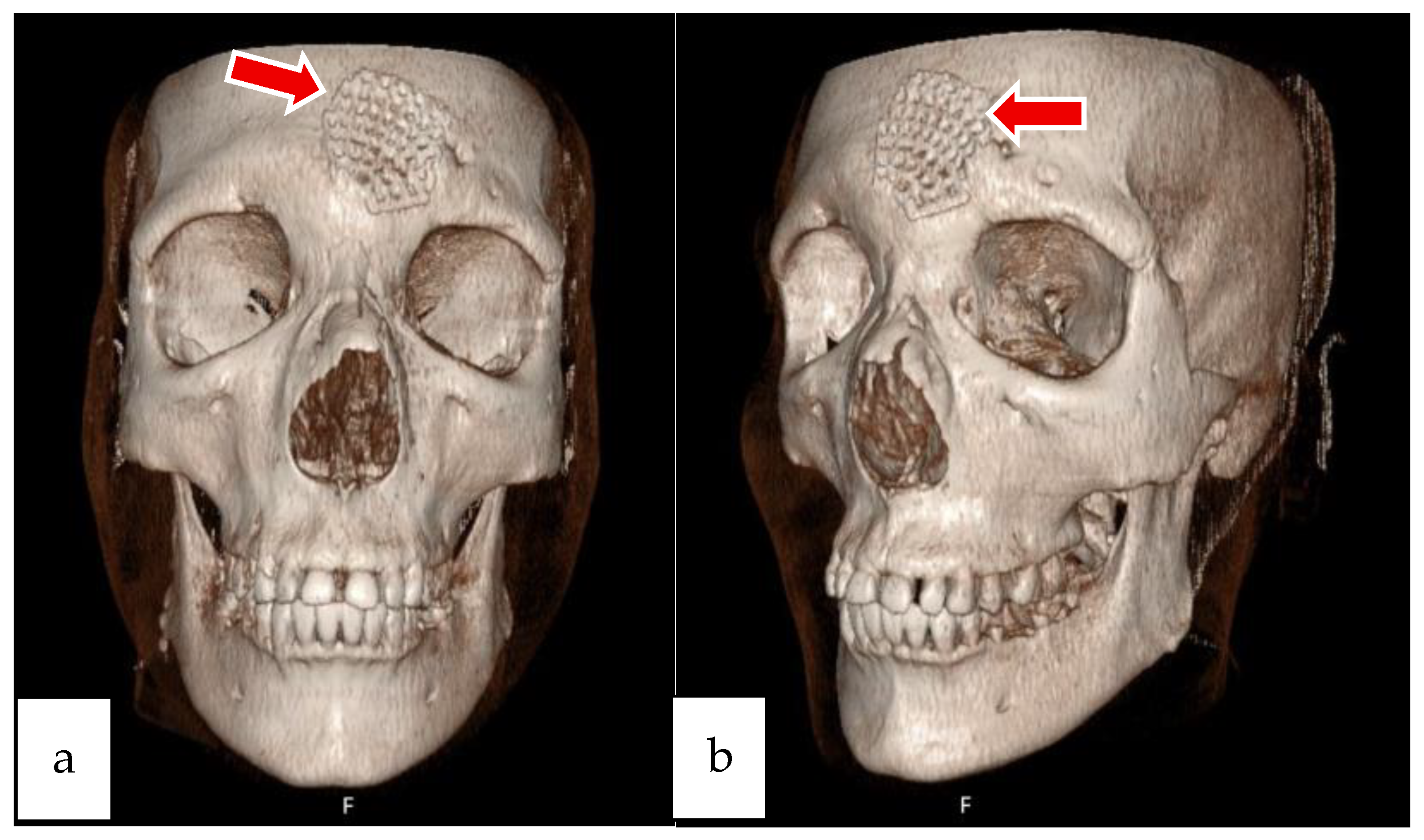 Sinusitis 09 00022 g007 Sinusitis 09 00022 g007