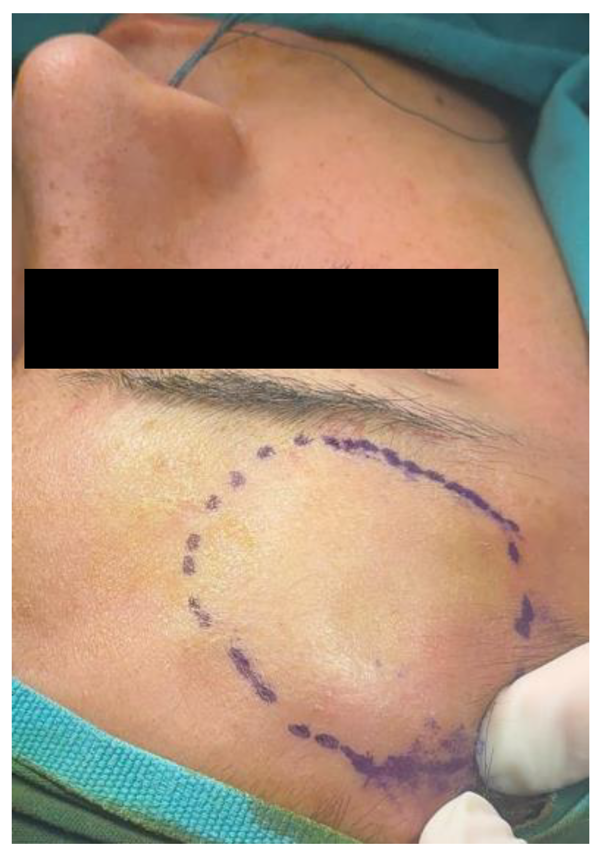 Sinusitis 09 00022 g009 Sinusitis 09 00022 g009