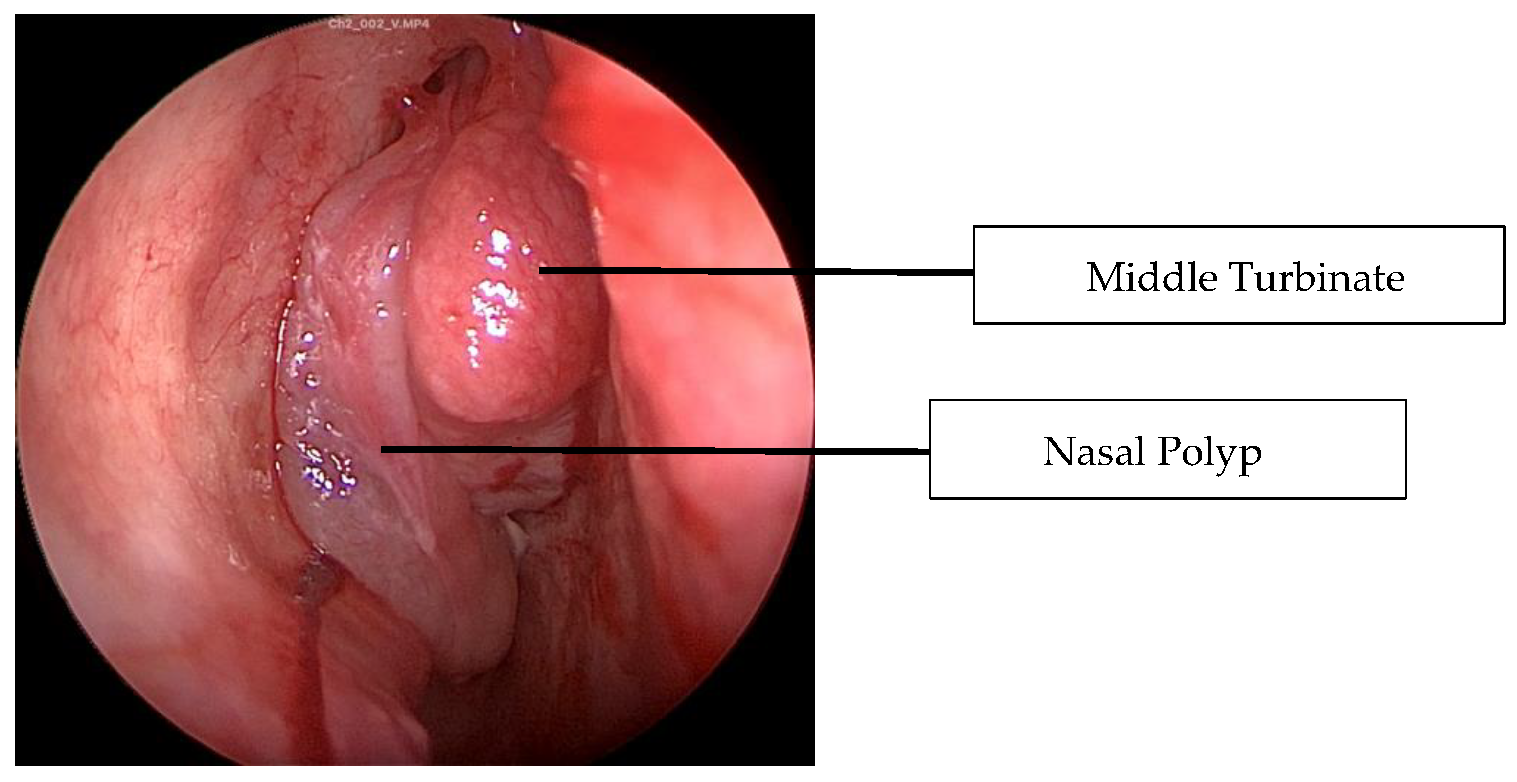Sinusitis 09 00022 g010 Sinusitis 09 00022 g010