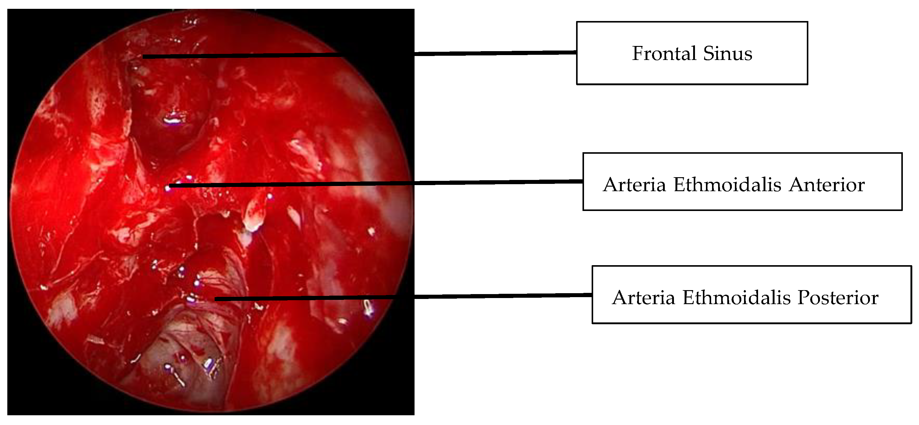 Sinusitis 09 00022 g013 Sinusitis 09 00022 g013