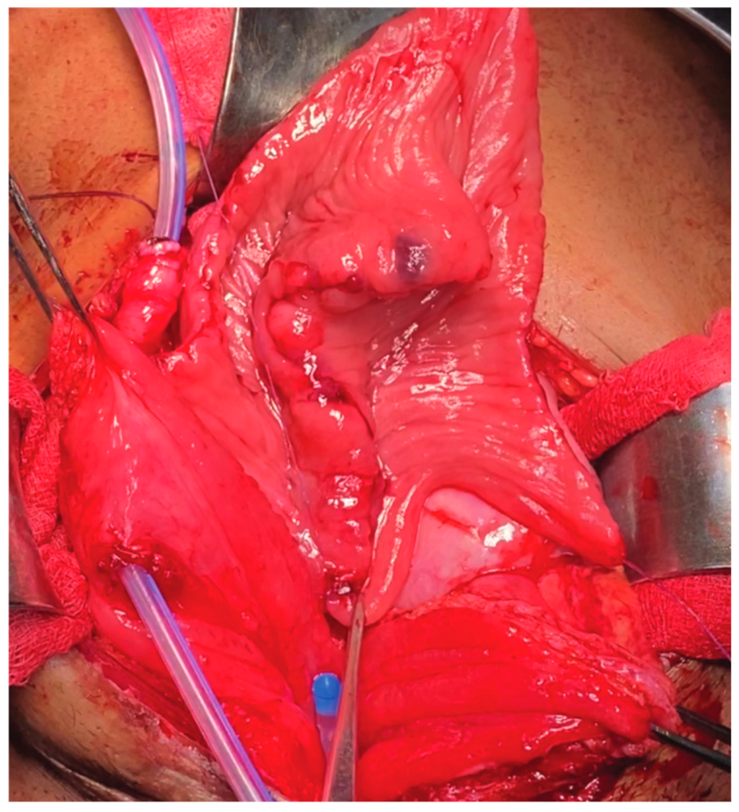 Siuj 04 00195 g004 Siuj 04 00195 g004