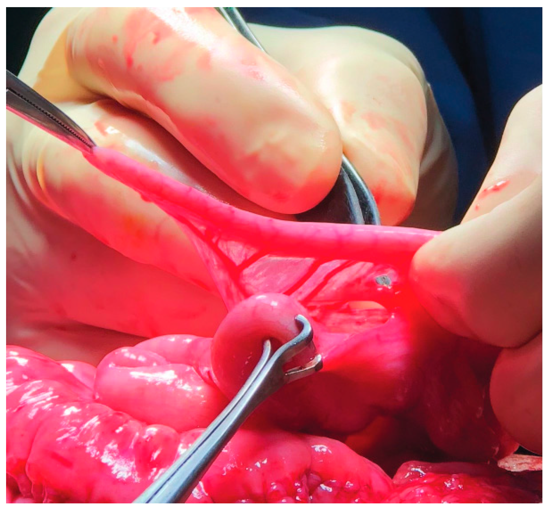 Siuj 04 00195 g005 Siuj 04 00195 g005