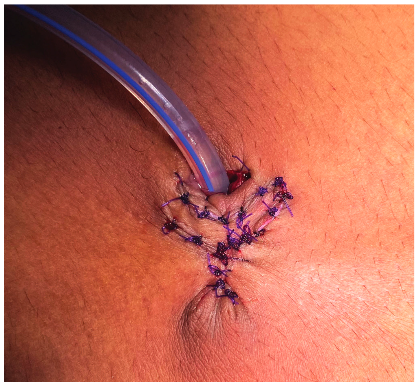 Siuj 04 00195 g008 Siuj 04 00195 g008