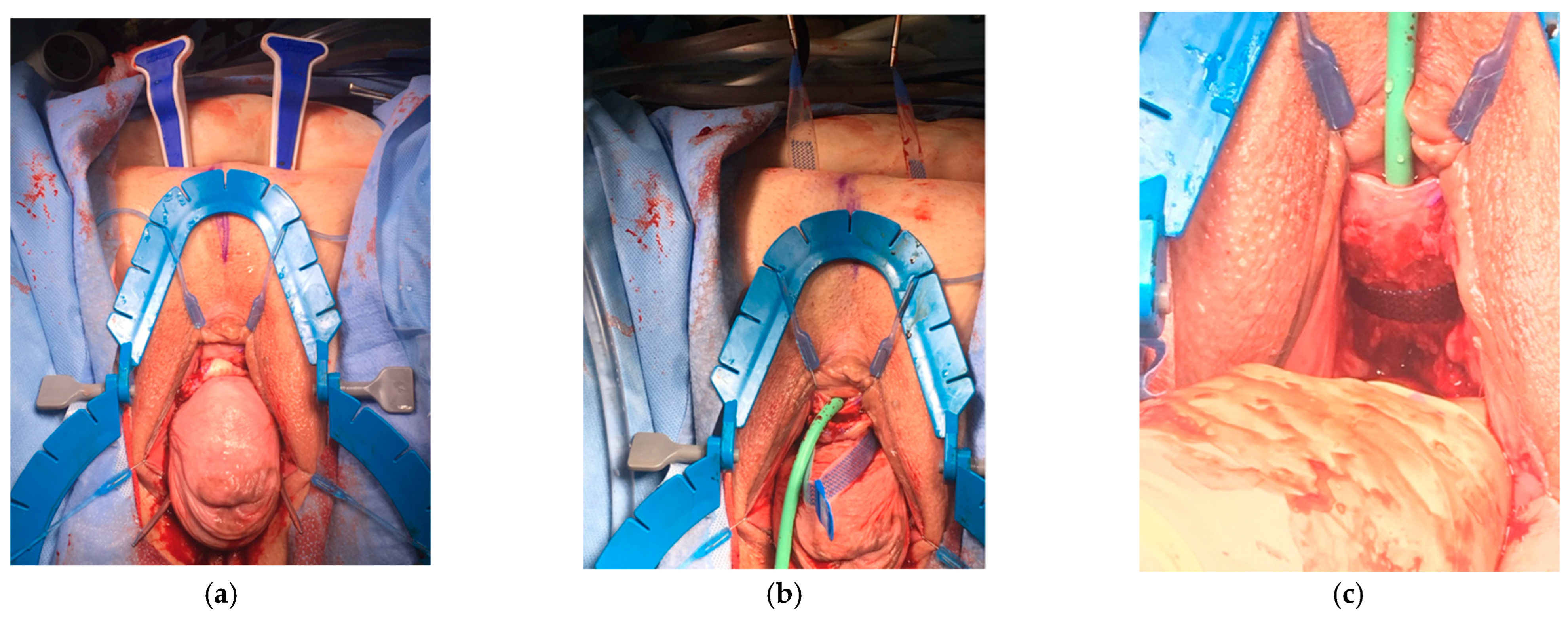 Siuj 06 00012 g006 Siuj 06 00012 g006