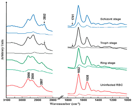 Illuminating Malaria: Spectroscopy's Vital Role in Diagnosis