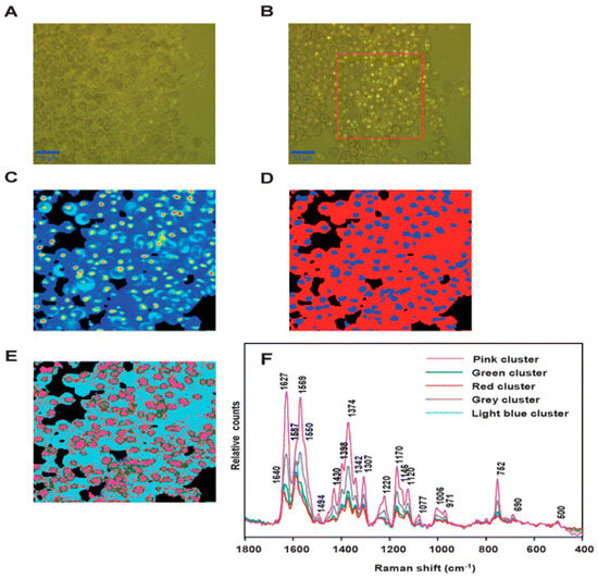 Illuminating Malaria: Spectroscopy's Vital Role in Diagnosis