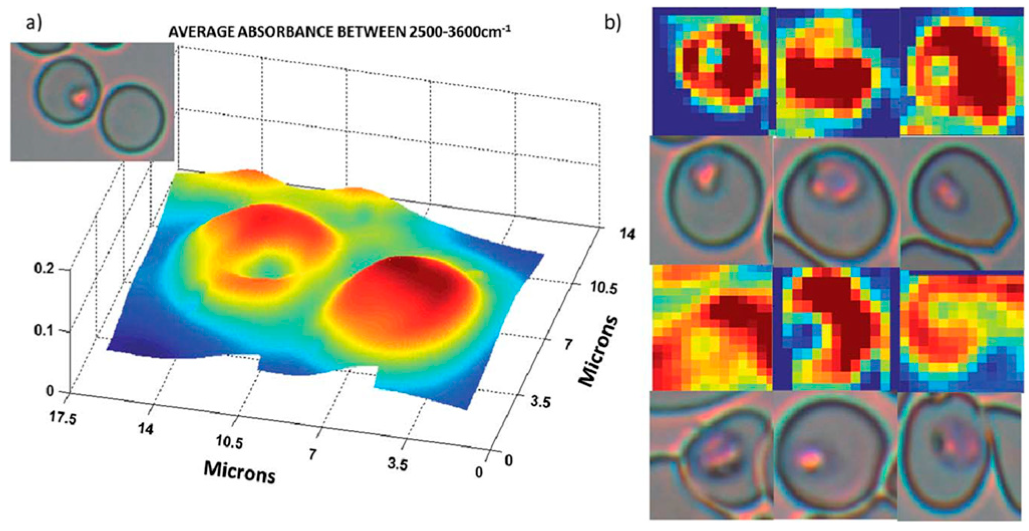 Spectroscj 02 00015 g011
