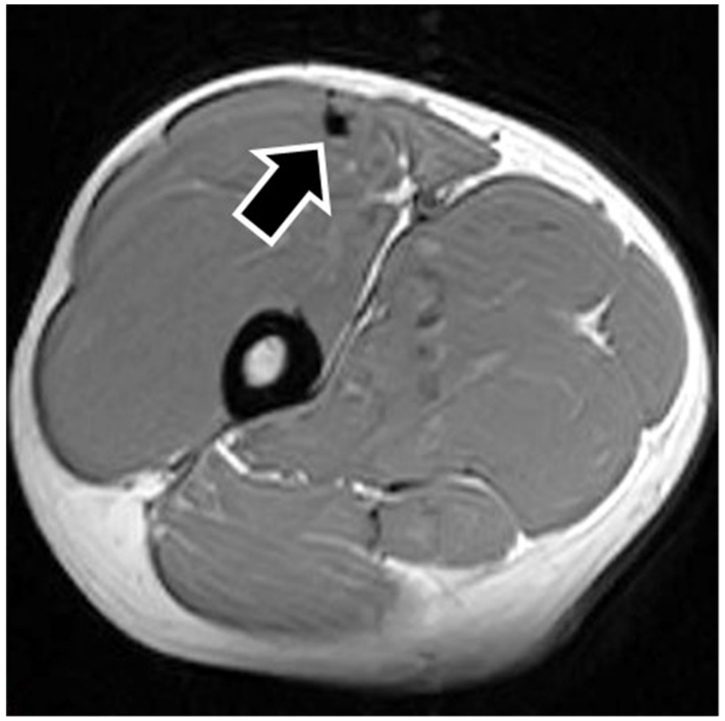 Sports 09 00150 g002 550