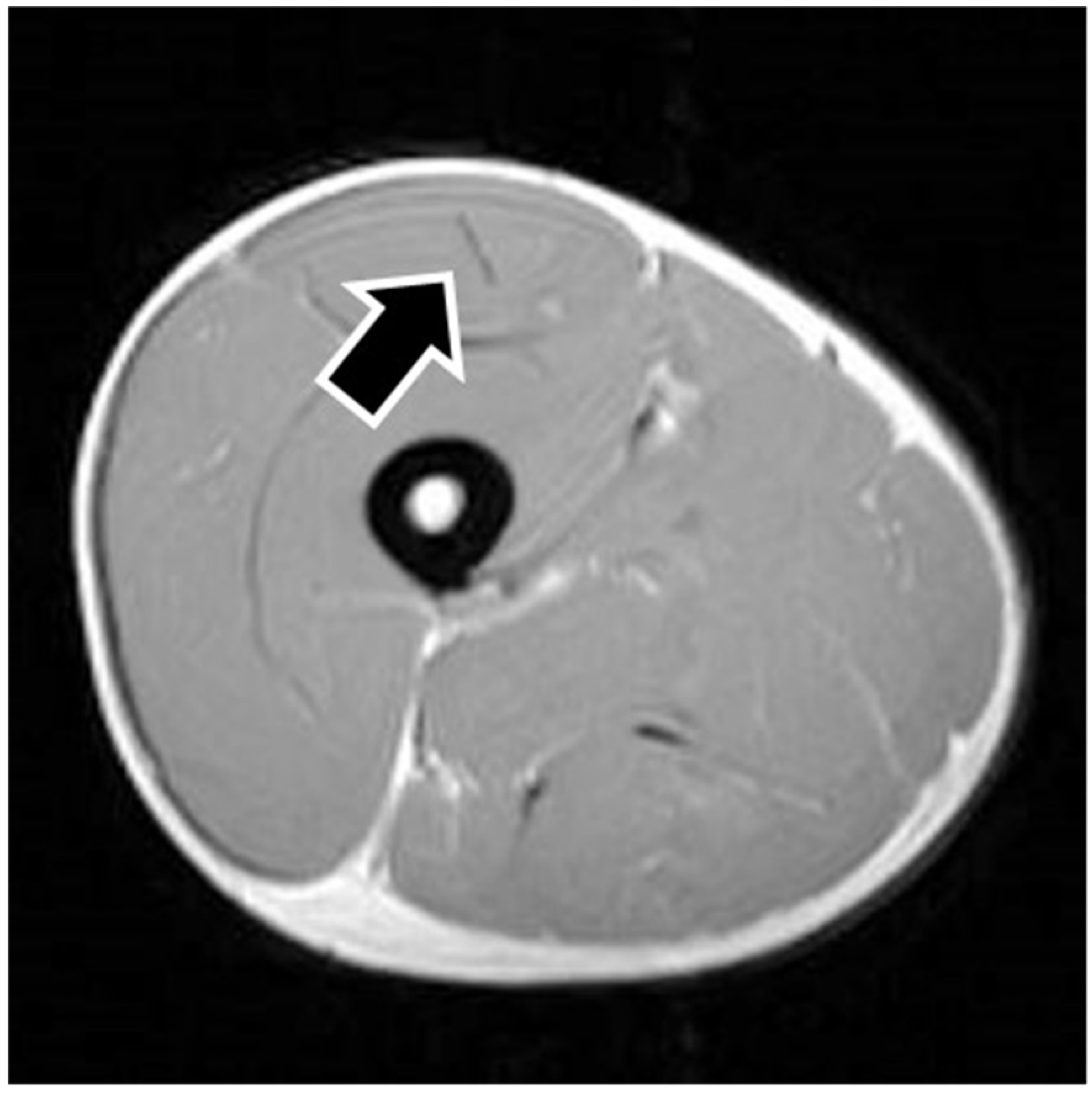 Sports 09 00150 g004 550