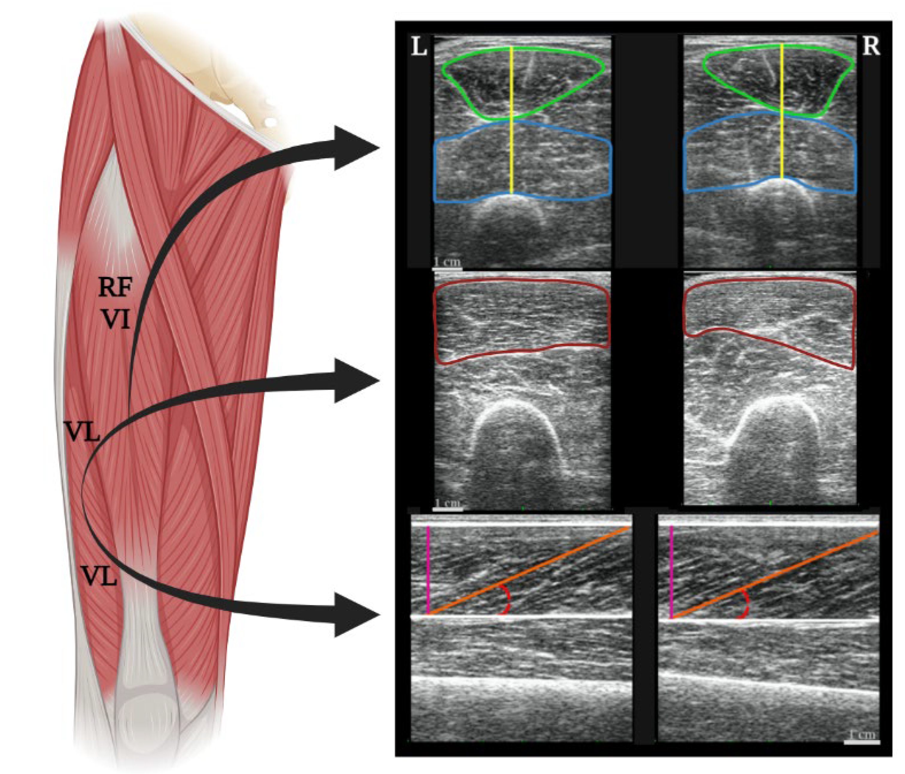 Sports 11 00022 g002