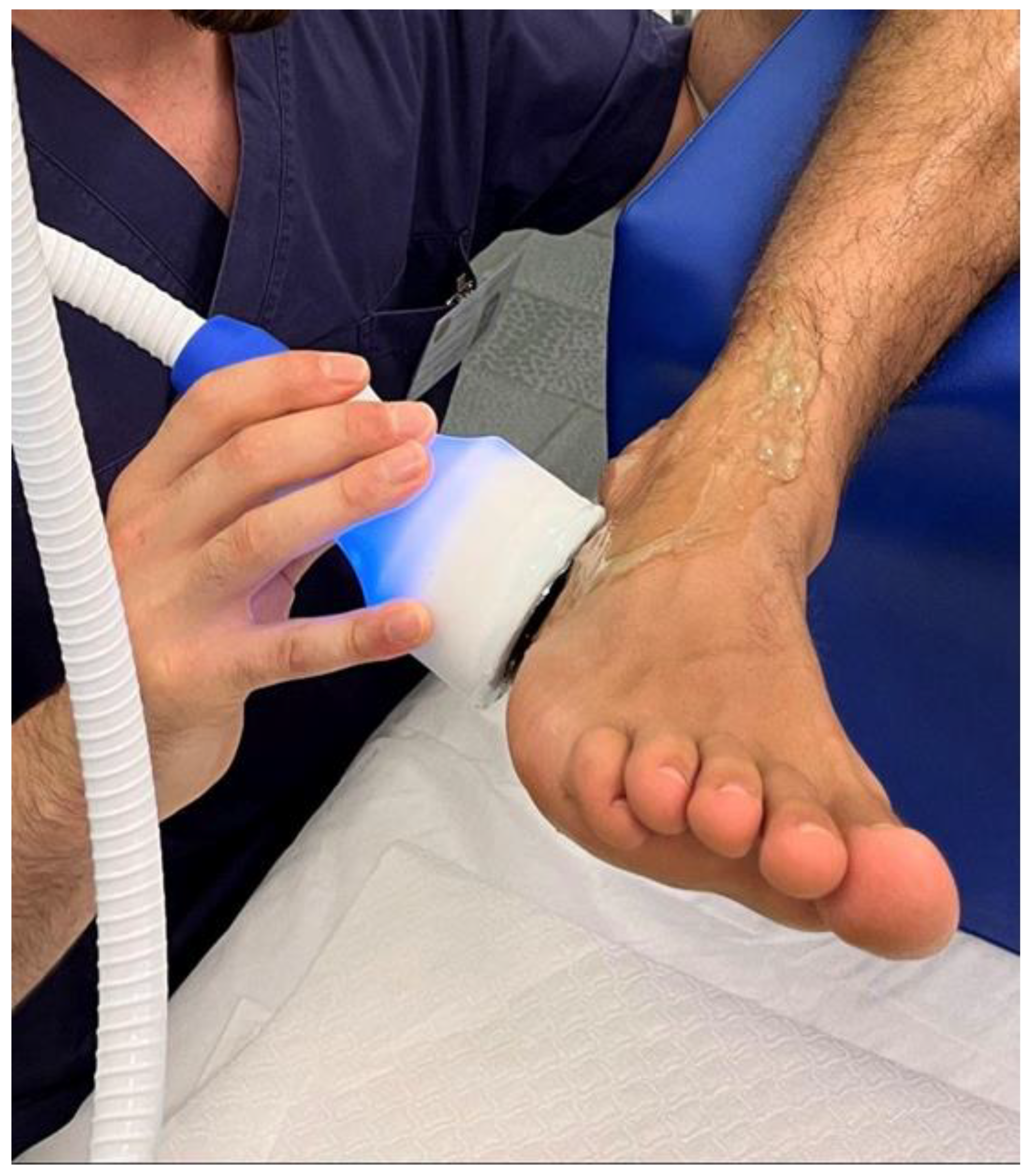 It's Just A Sprain” – The Importance Of Physio For Ankle Sprains