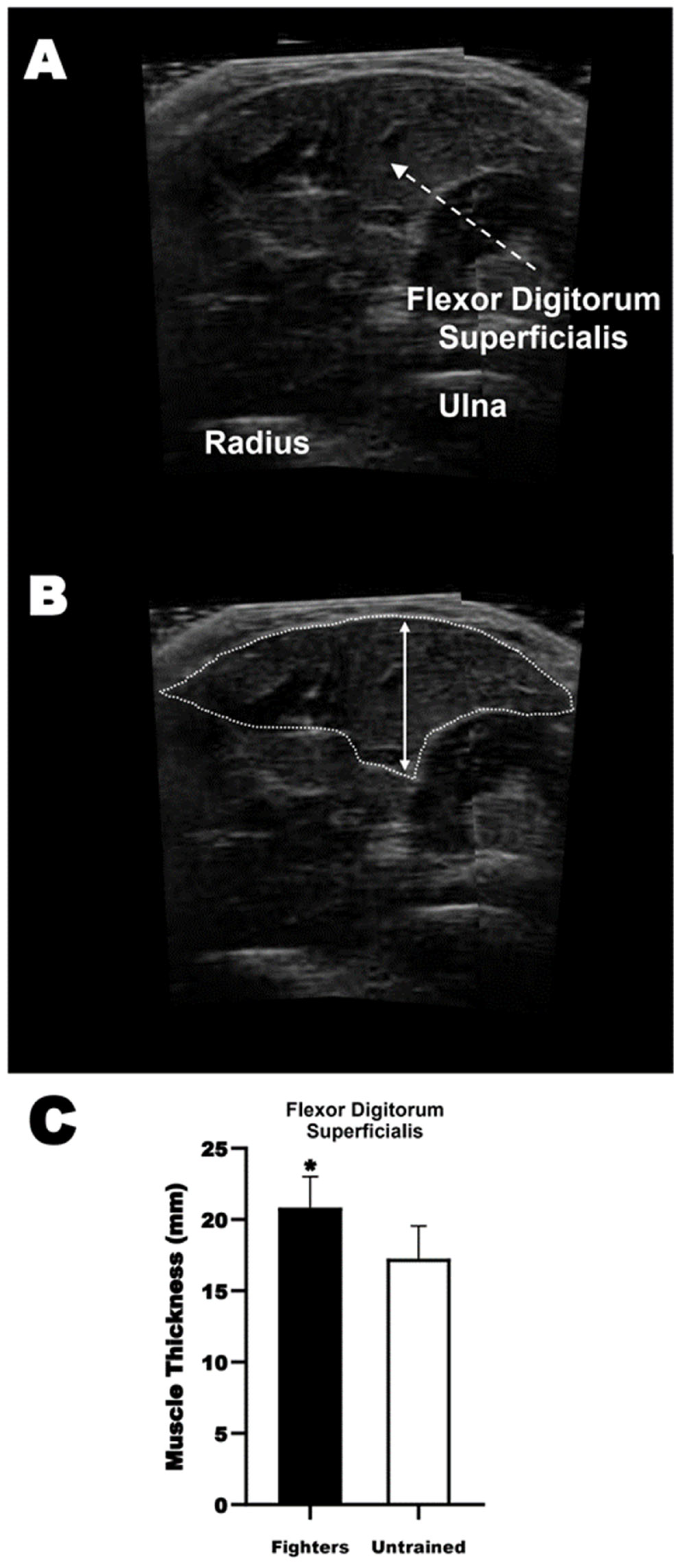Sports 12 00066 g003 Sports 12 00066 g003
