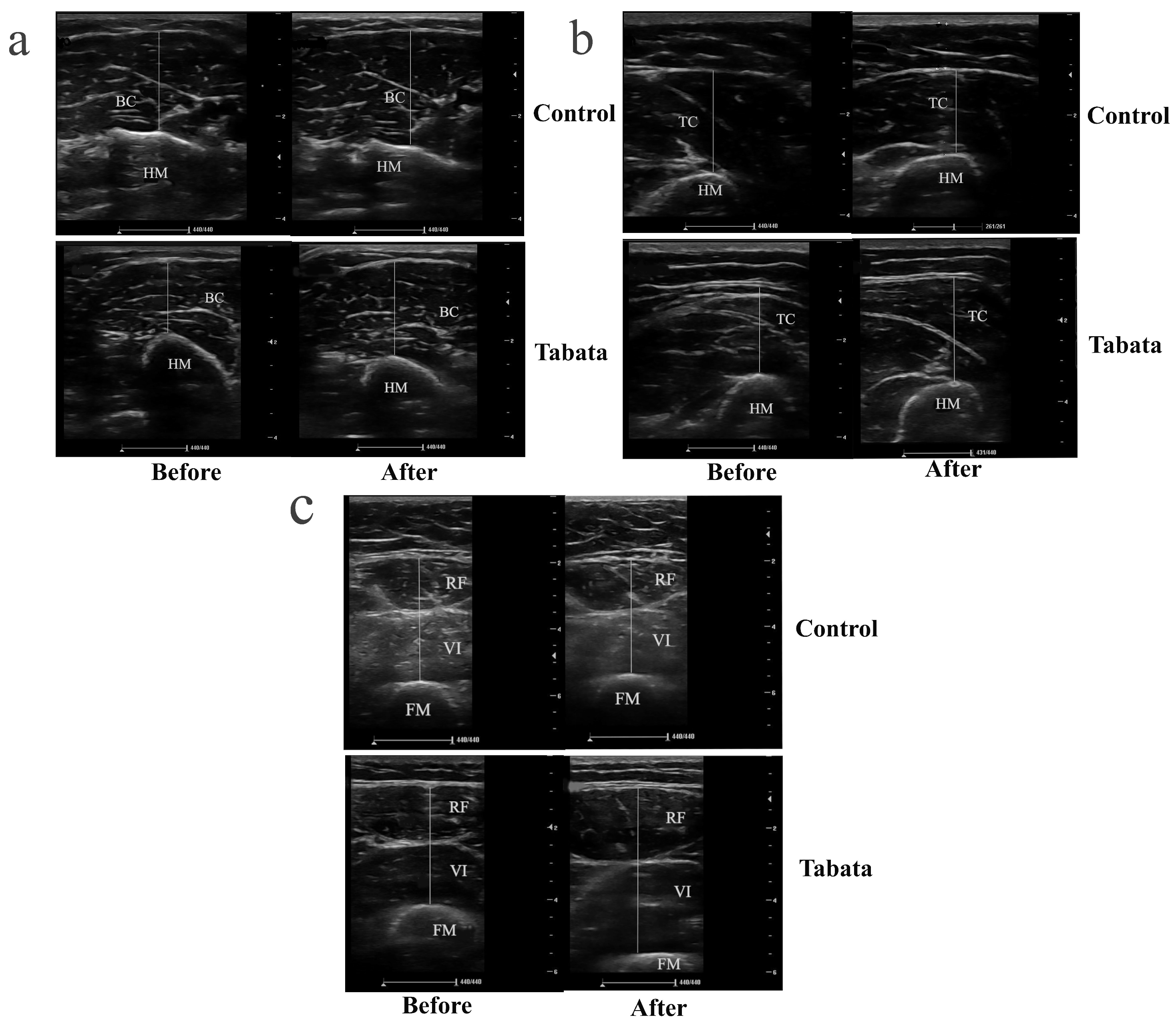 Sports 13 00099 g004