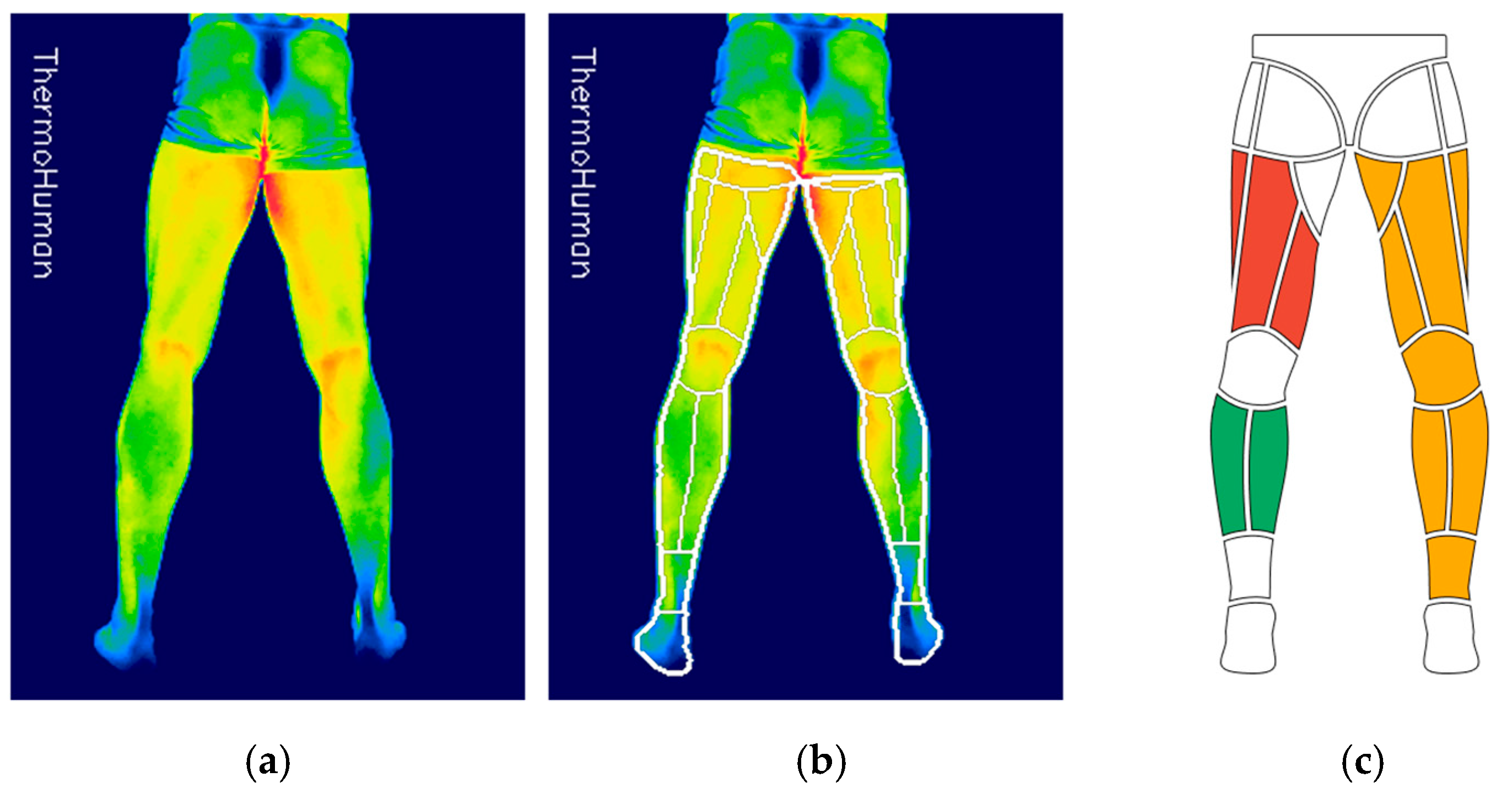 Sports 13 00443 g001 Sports 13 00443 g001