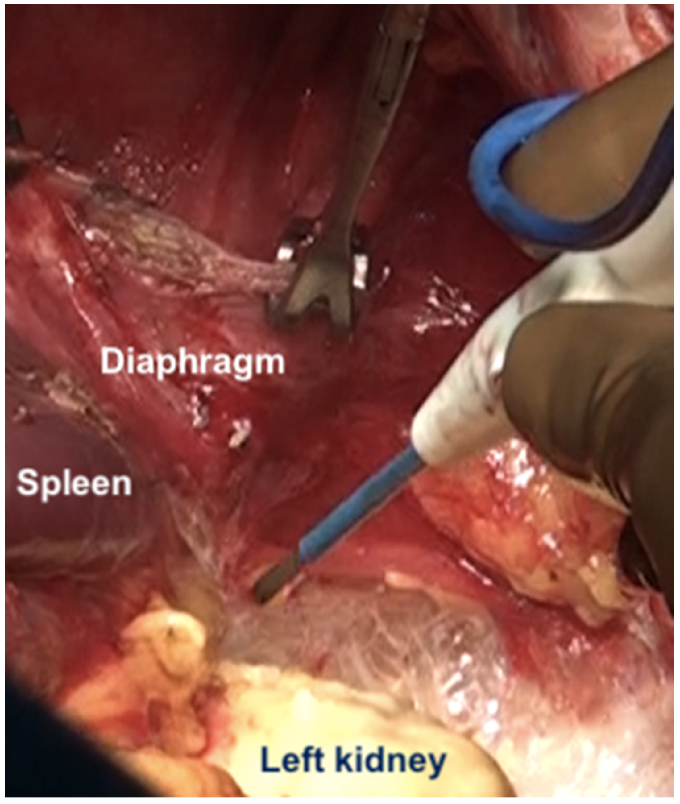 Std 12 00001 g017 Std 12 00001 g017