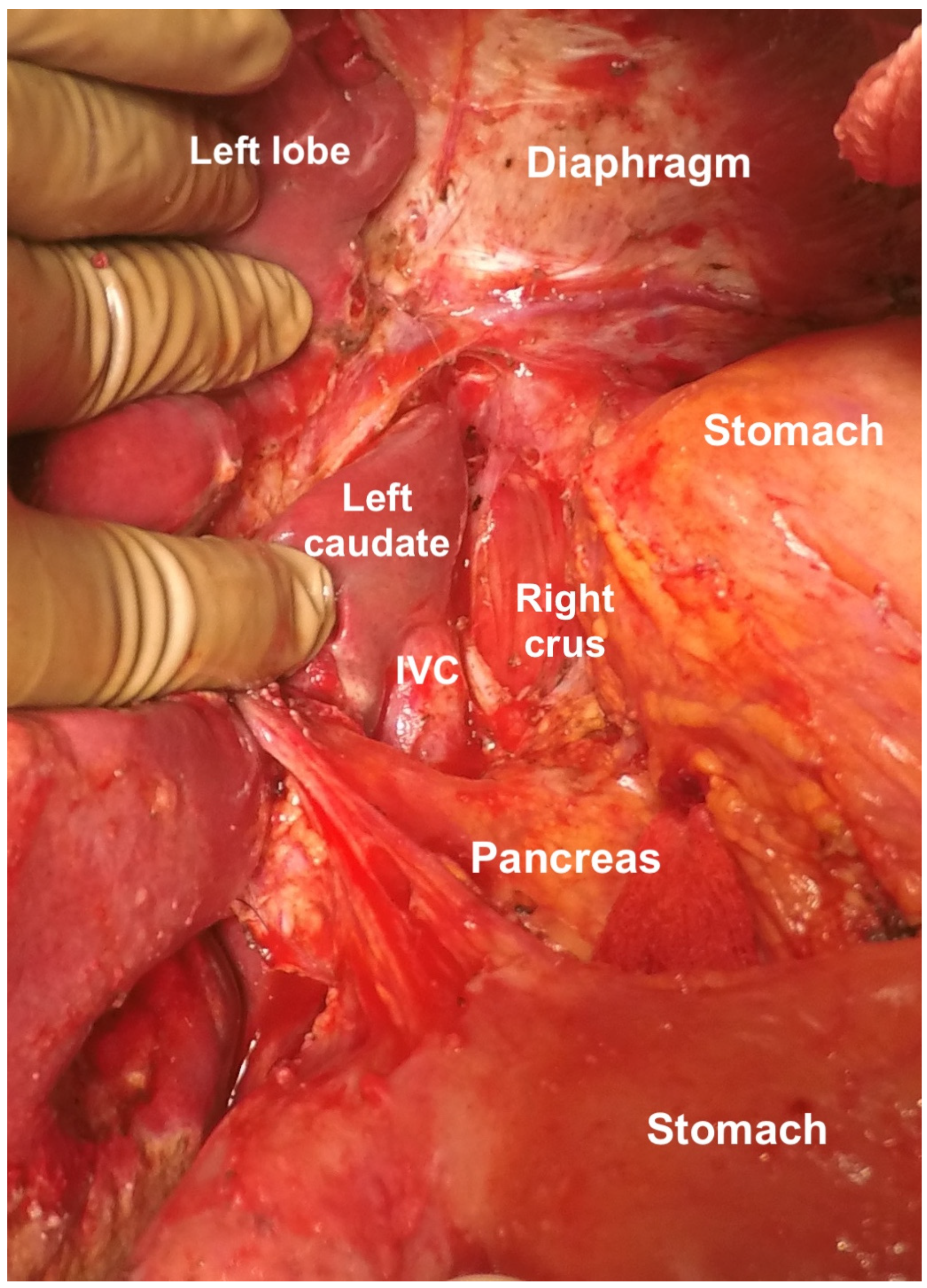 Std 12 00001 g025 Std 12 00001 g025