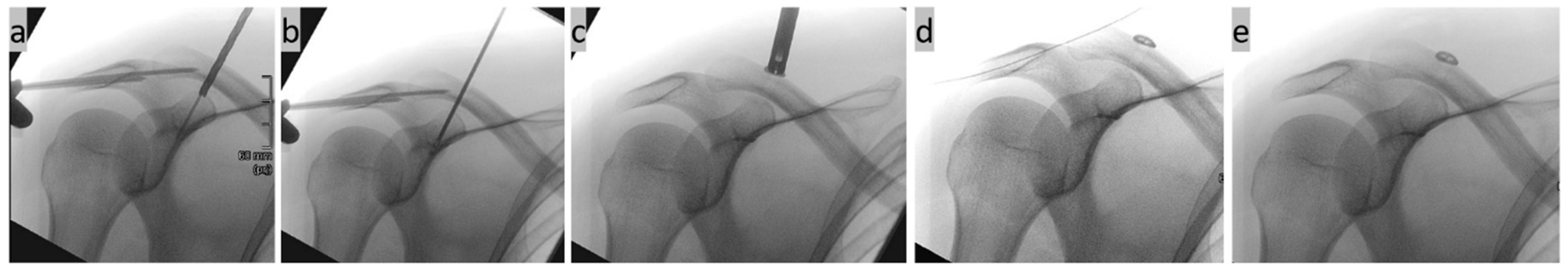 Std 13 00014 g008 Std 13 00014 g008