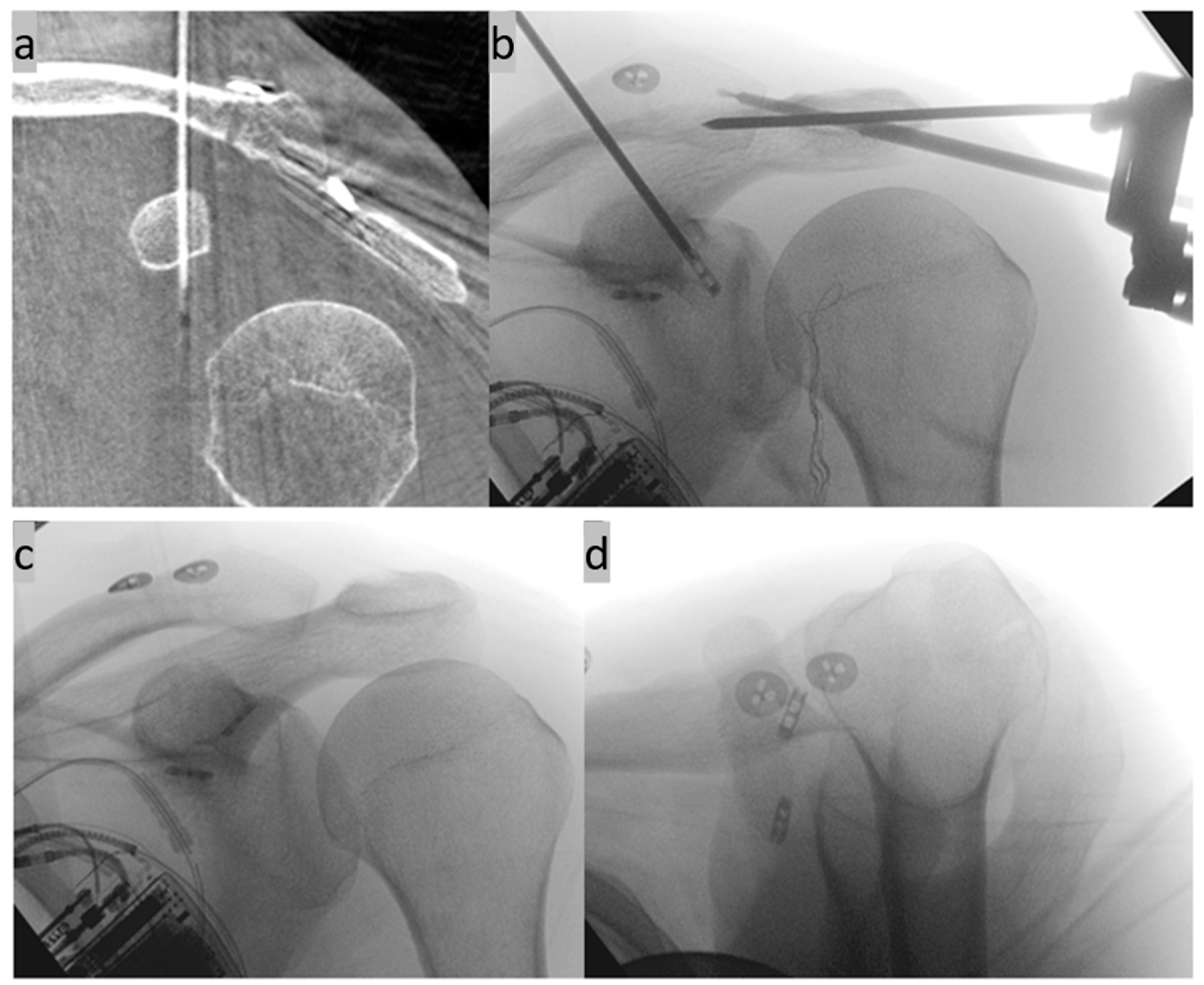 Std 13 00014 g009a Std 13 00014 g009a