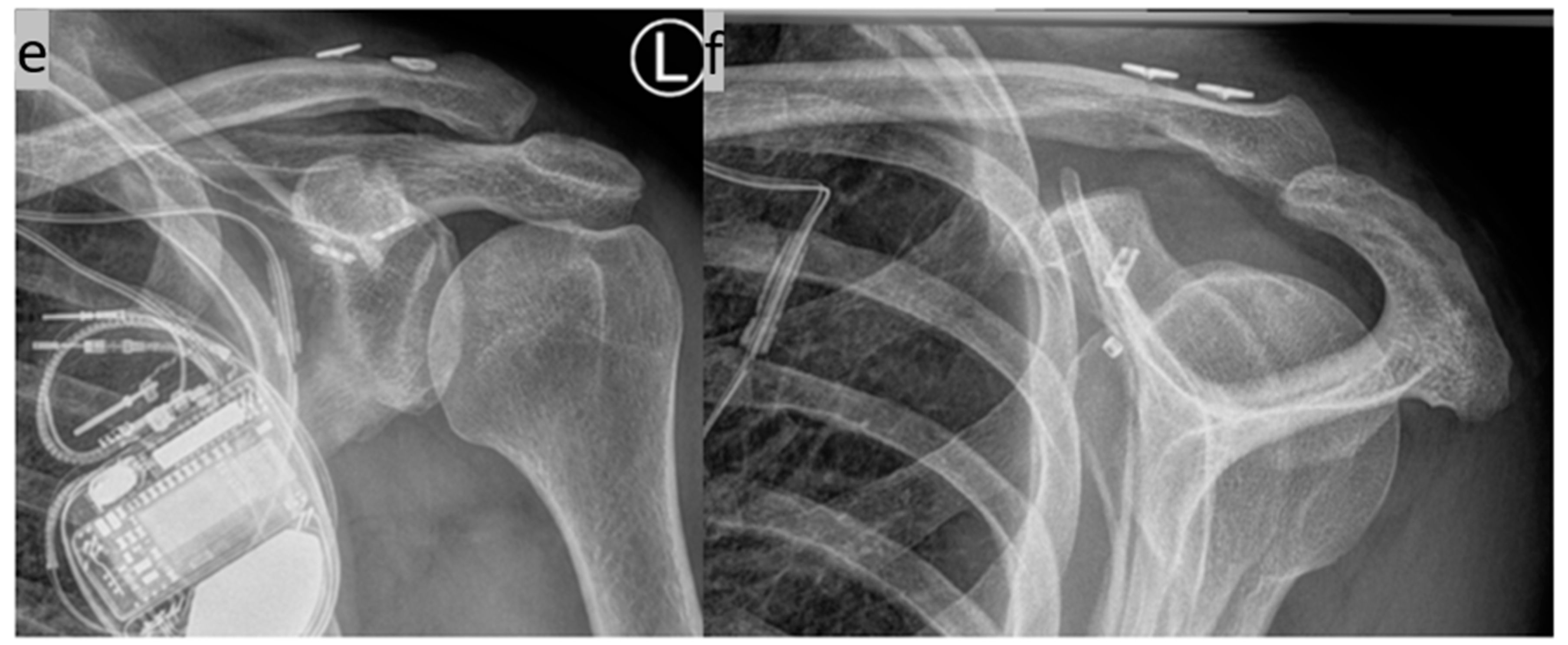 Std 13 00014 g009b Std 13 00014 g009b