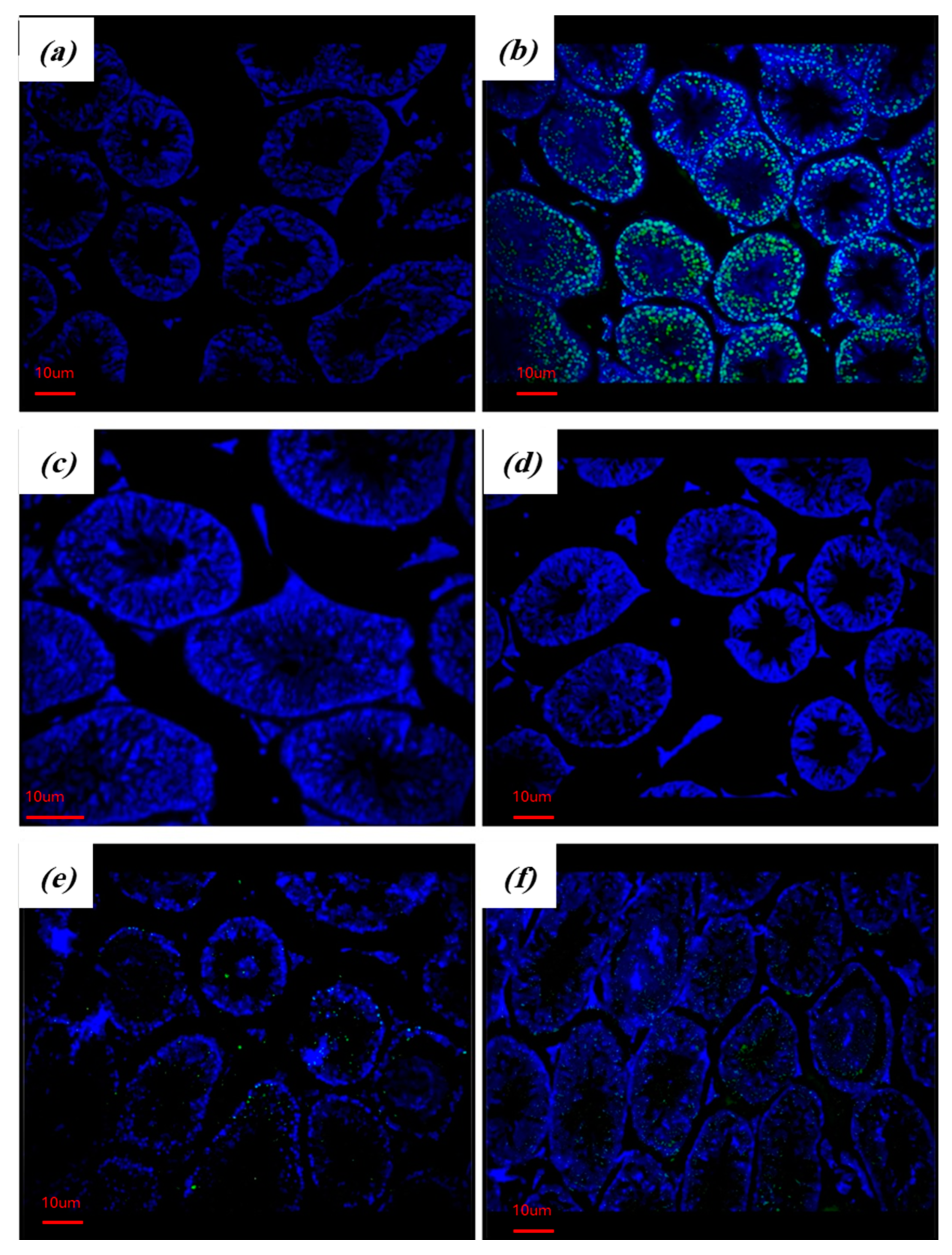Stresses 04 00032 g005