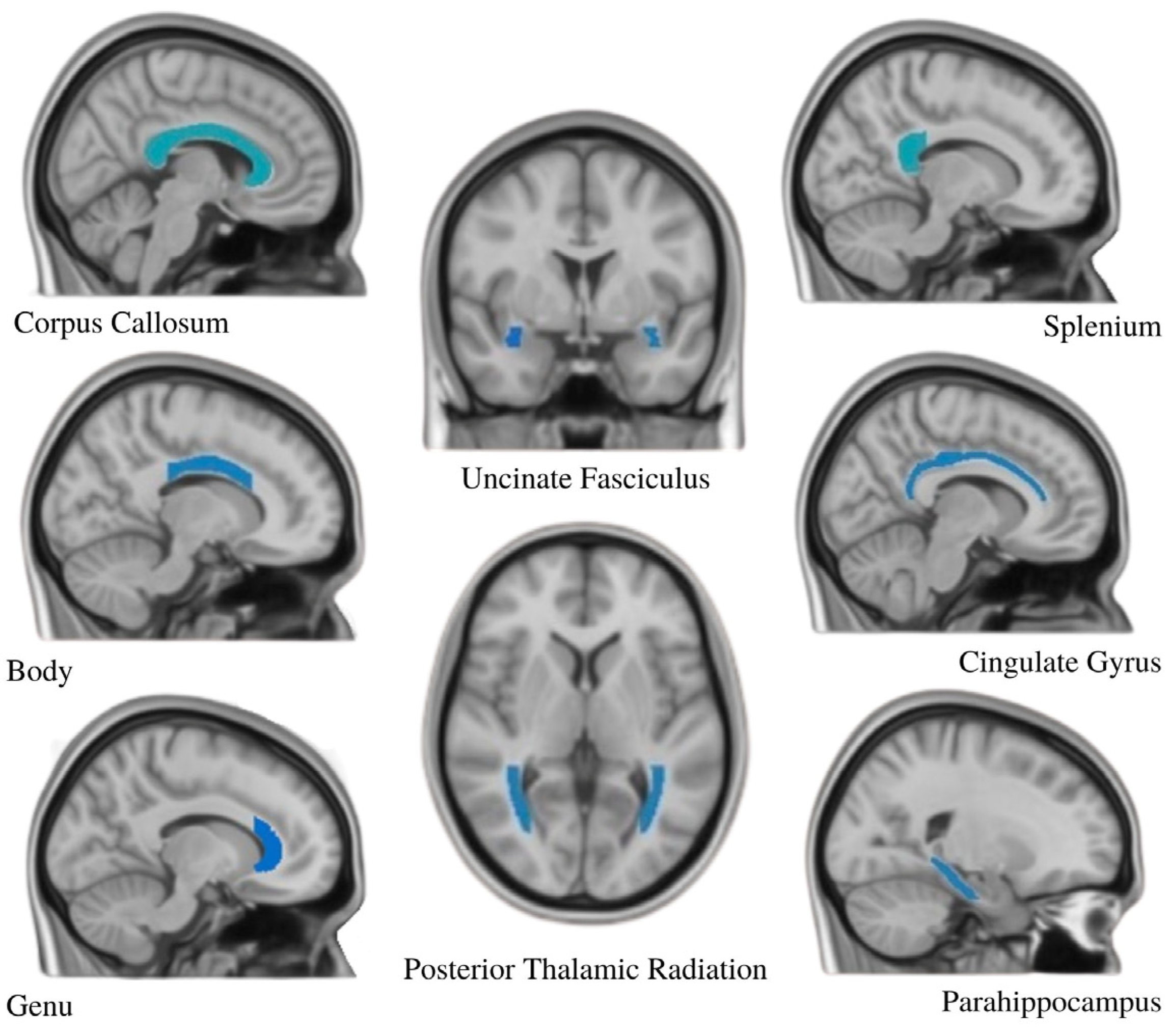 Stresses 05 00019 g003