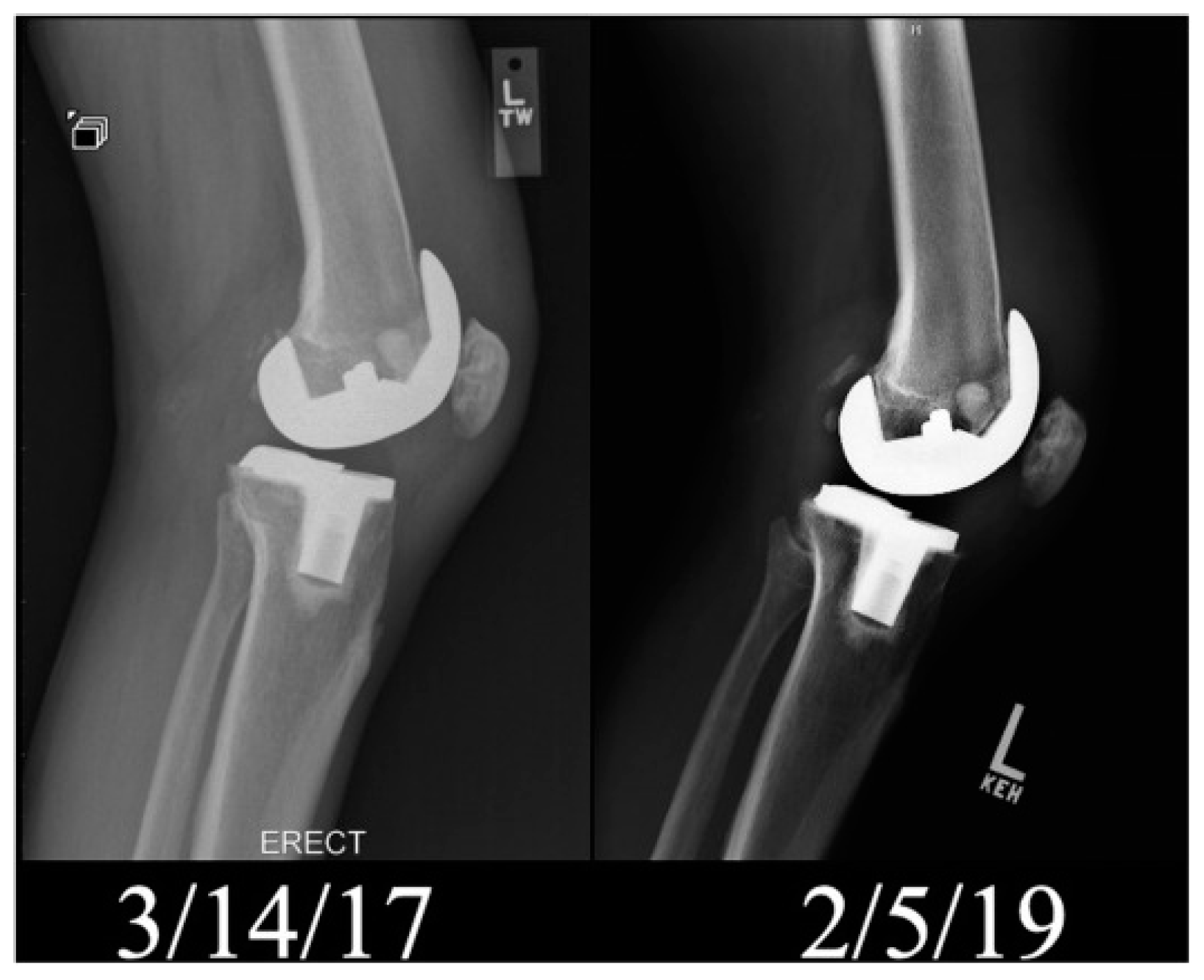 Surfaces 04 00018 g009 Surfaces 04 00018 g009