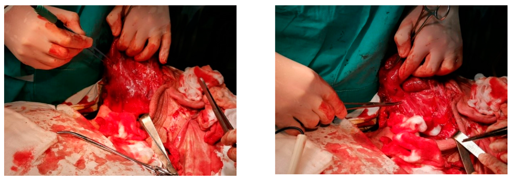 Surgeries 01 00006 g003