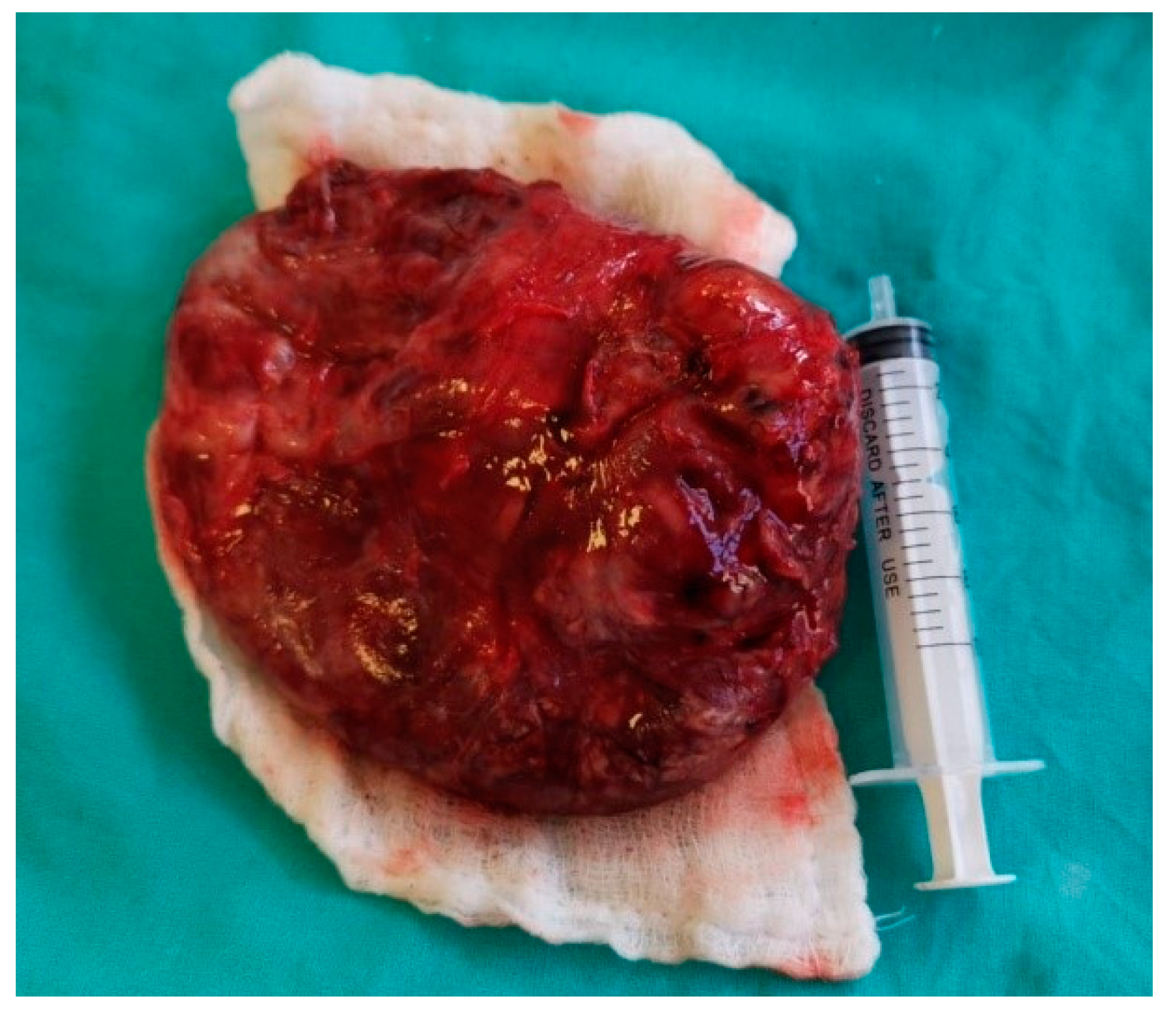 Surgeries 01 00006 g004