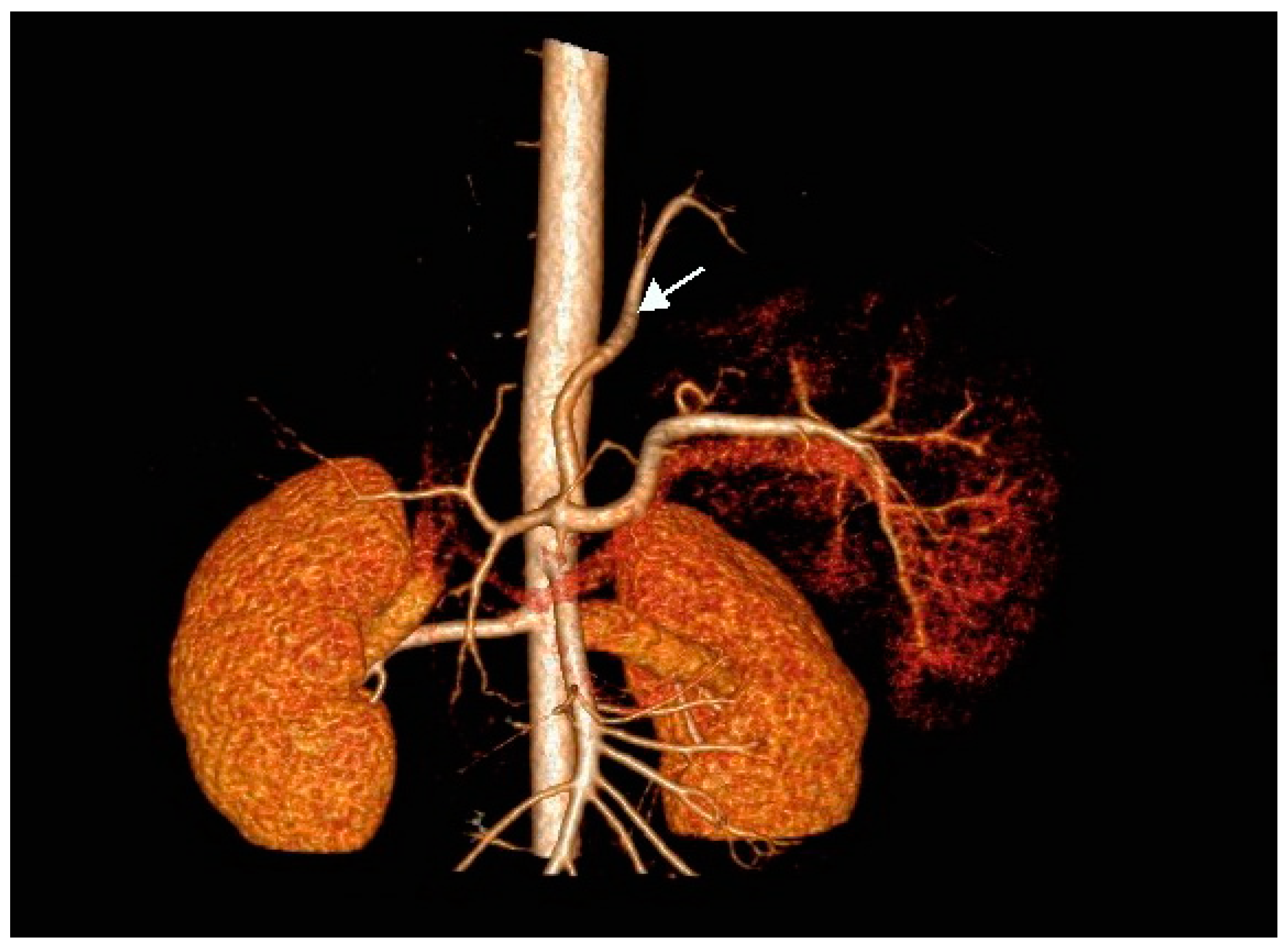 Surgeries 02 00009 g002a