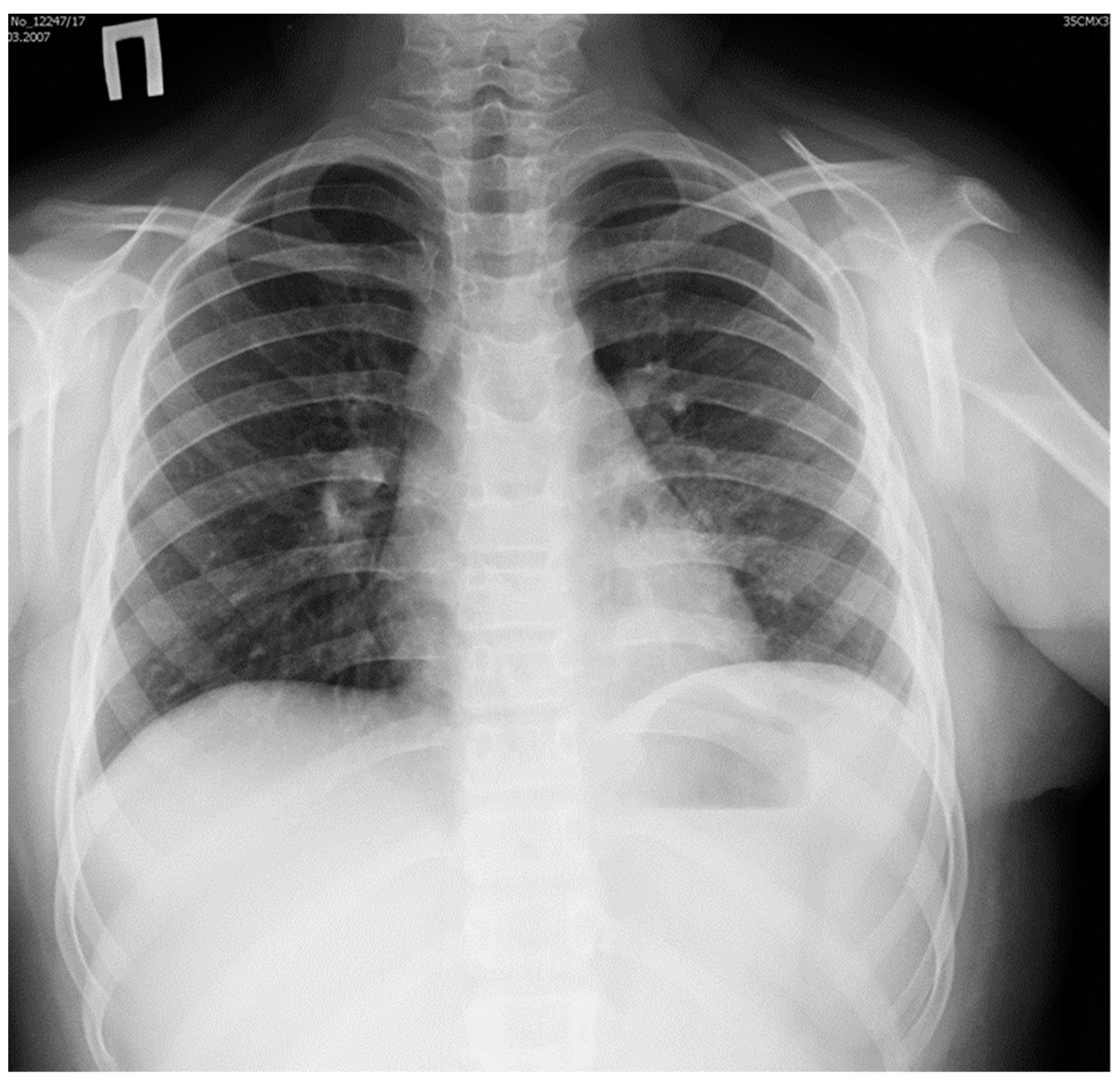 Surgeries 02 00009 g004