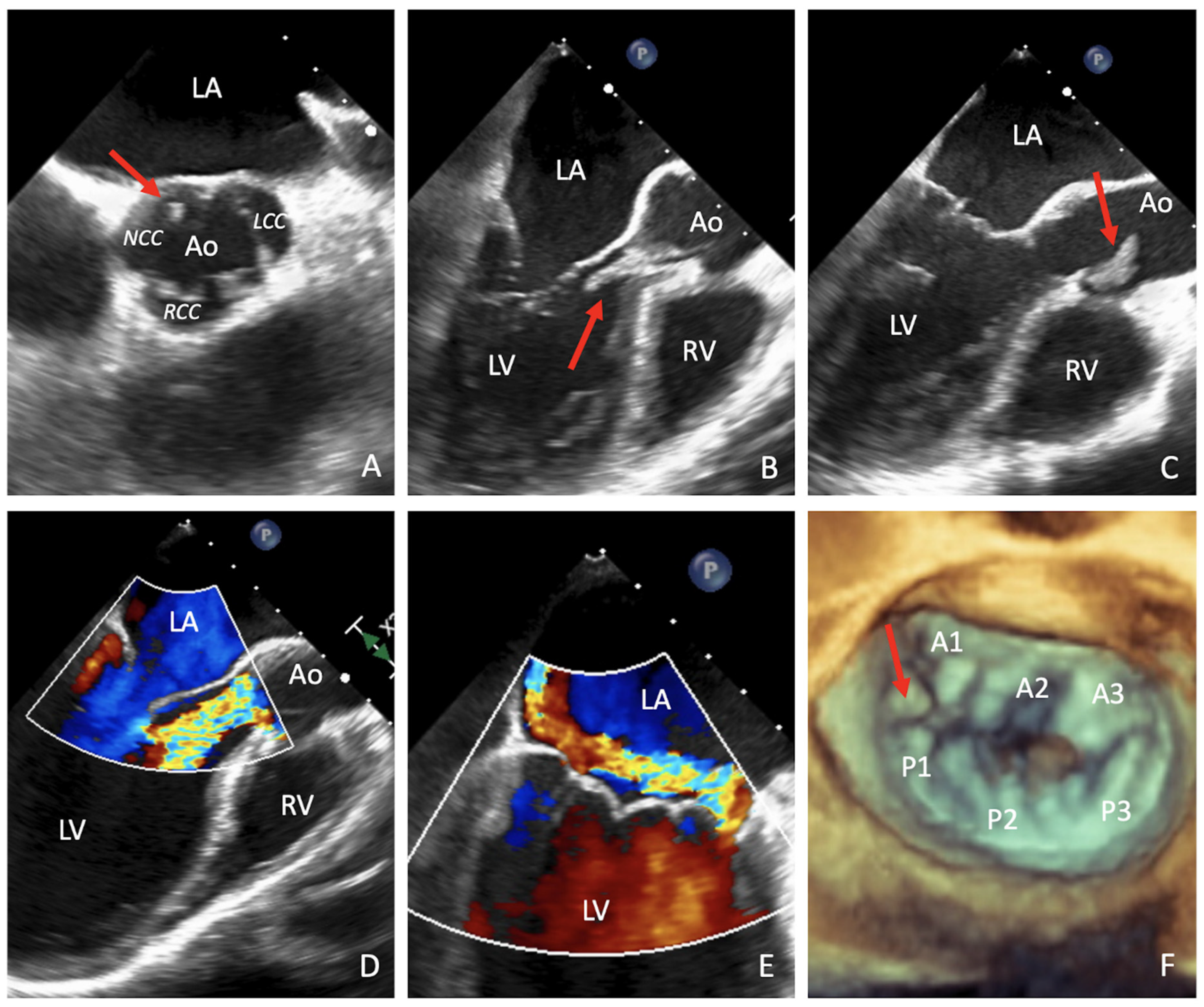 Surgeries 02 00010 g001 Surgeries 02 00010 g001