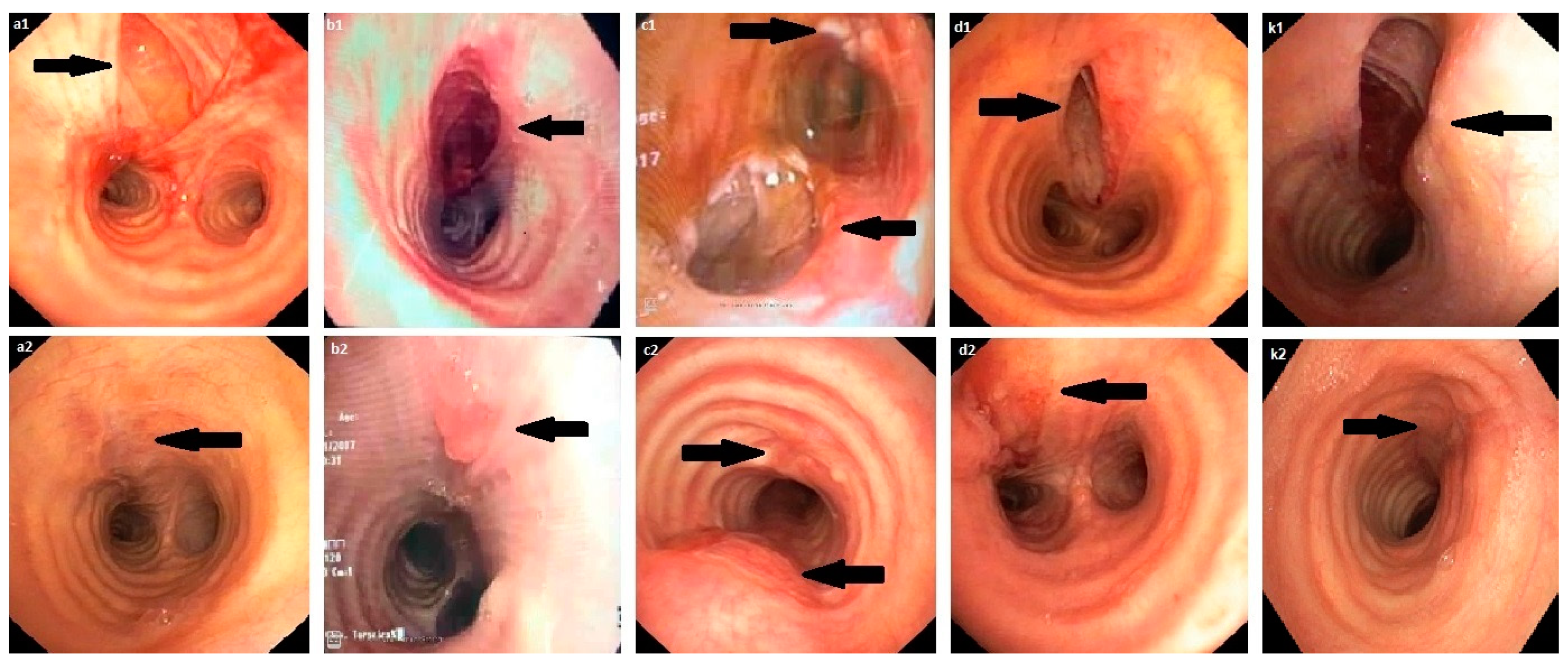 Surgeries 02 00024 g001 550