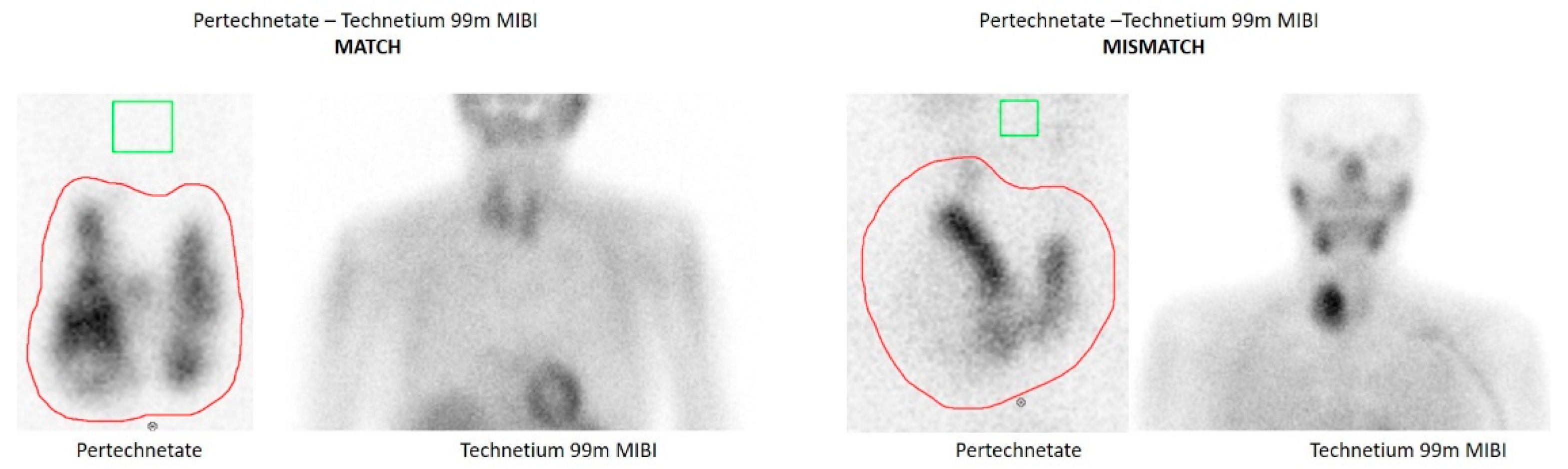 Surgeries 02 00026 g001 550