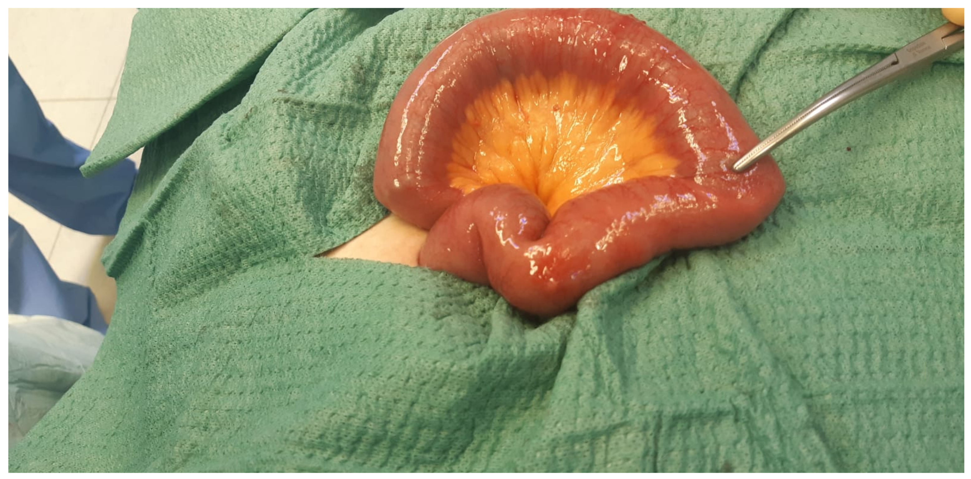 Surgeries 02 00037 g002