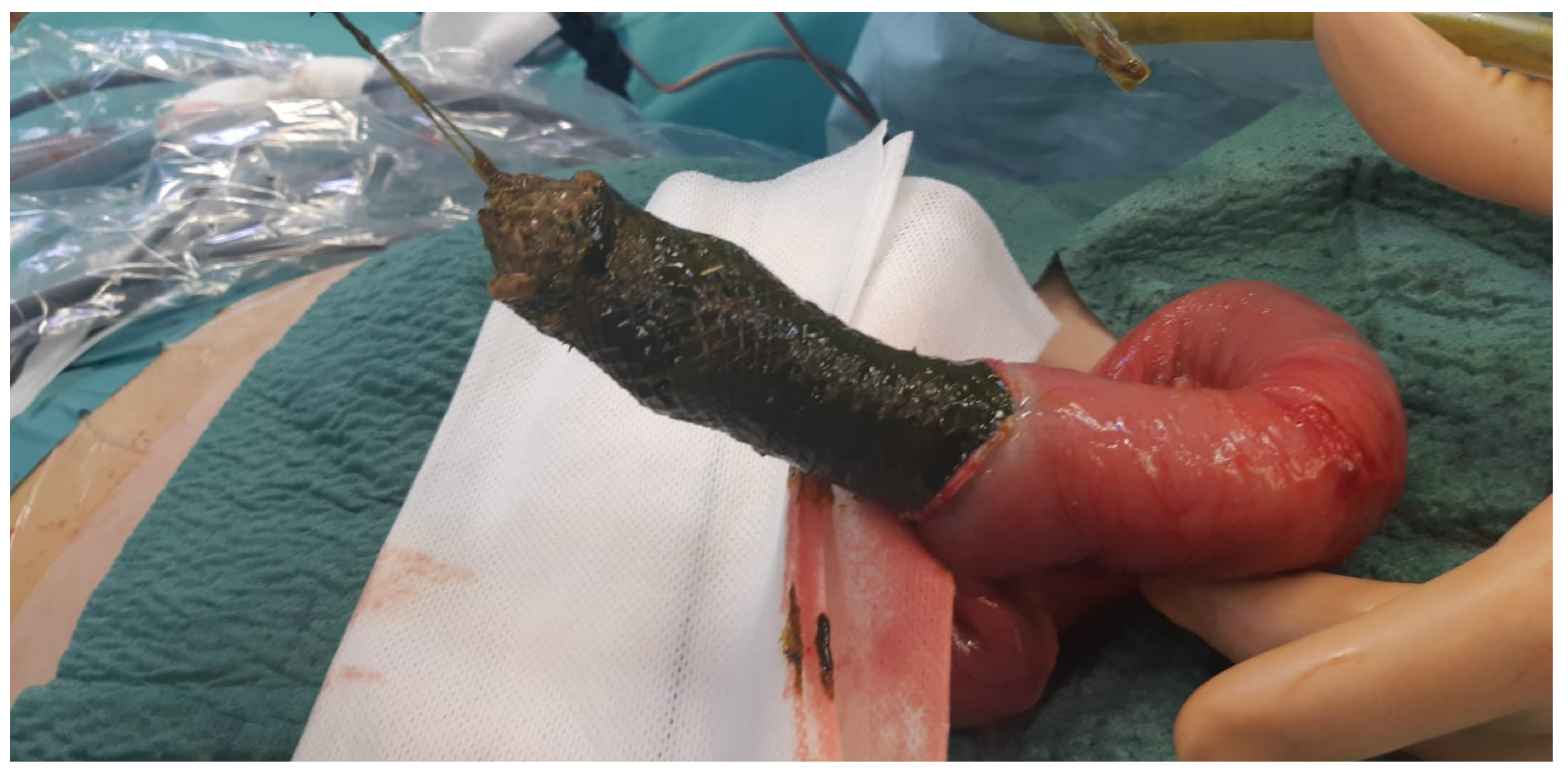 Surgeries 02 00037 g003