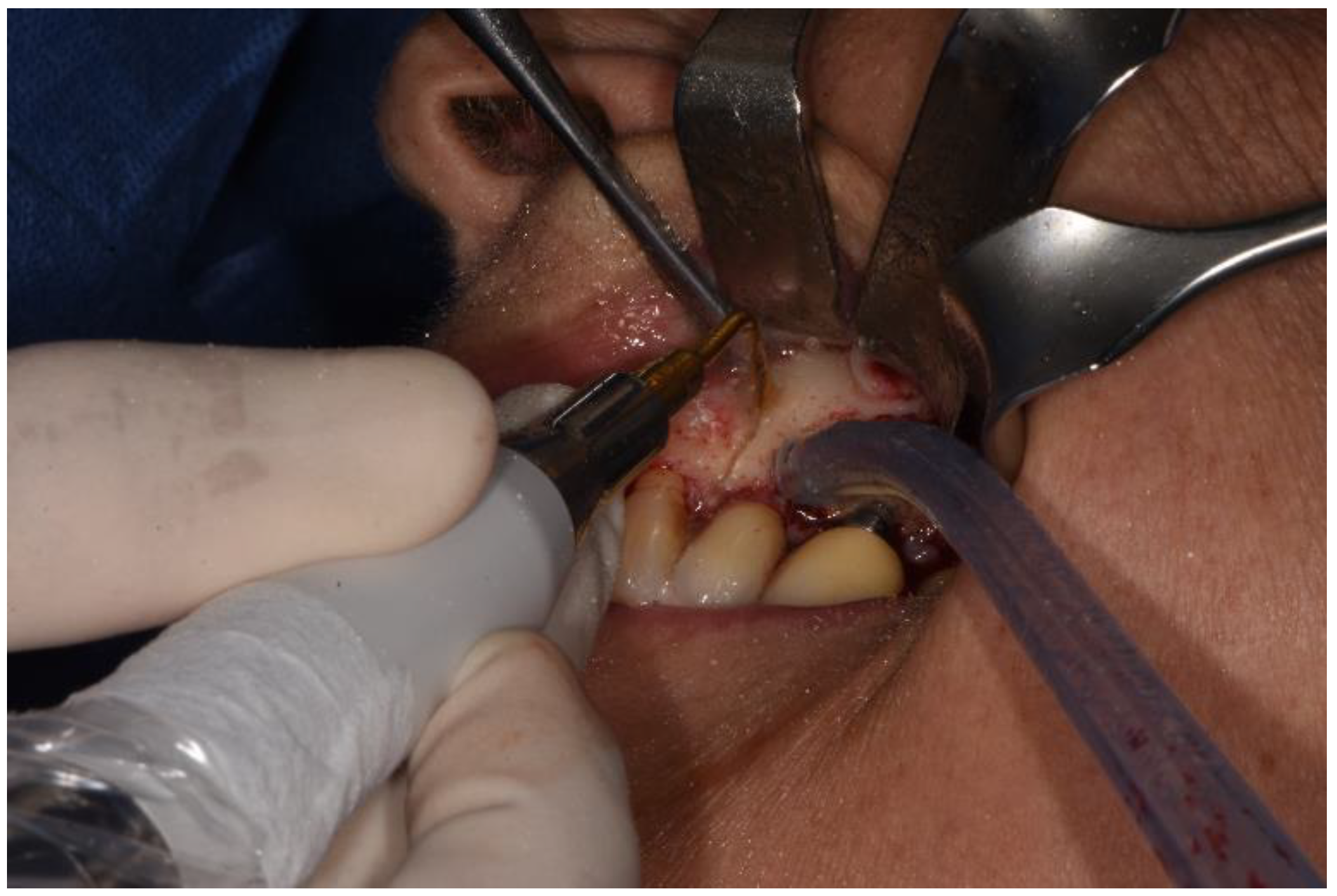 Surgeries 02 00040 g004 550