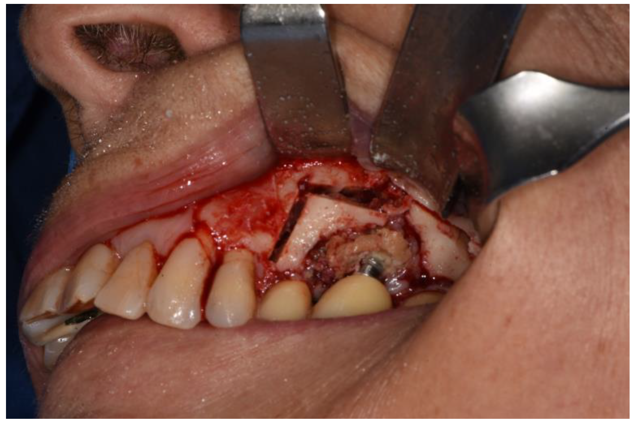 Surgeries 02 00040 g005 550