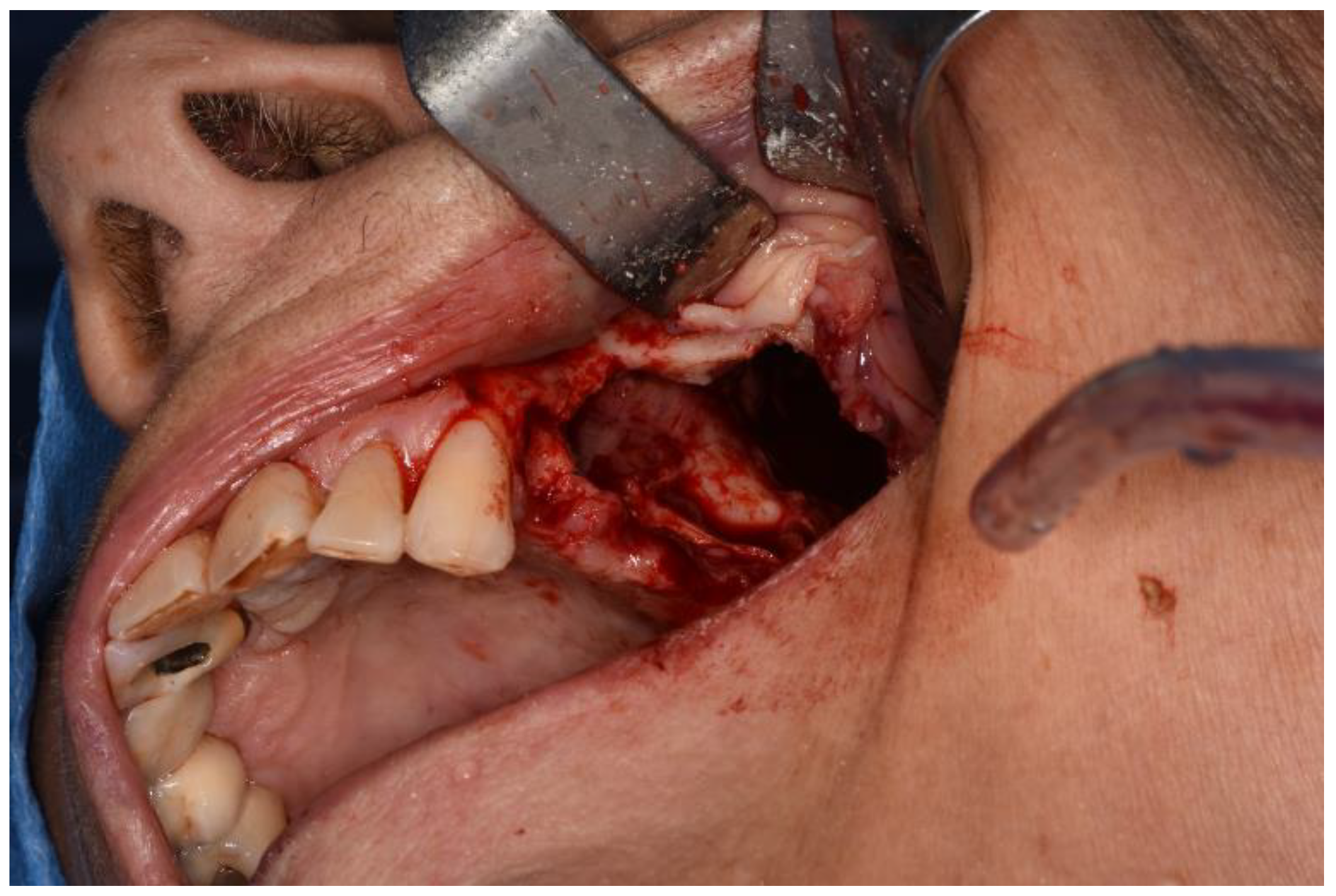 Surgeries 02 00040 g006 550