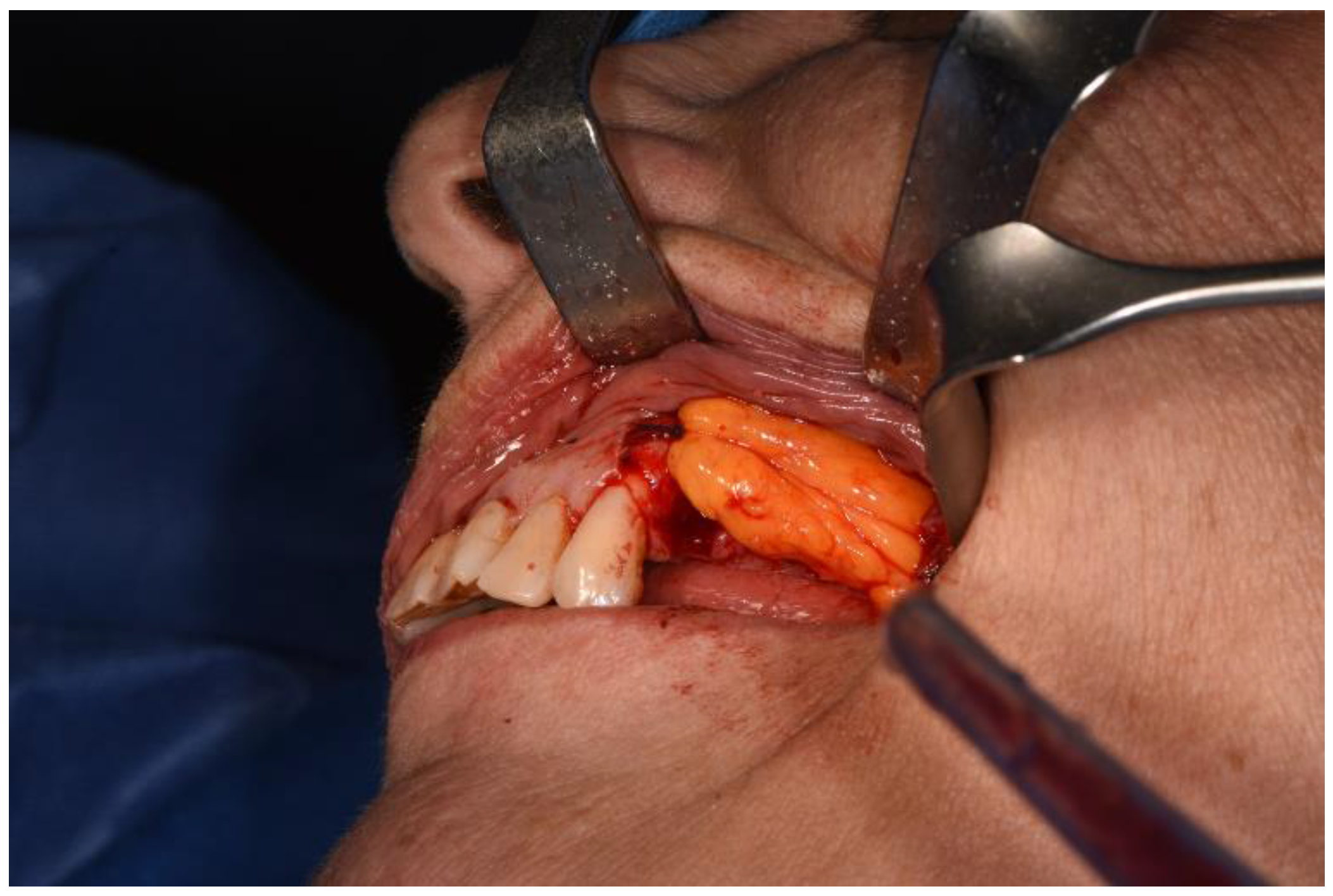 Surgeries 02 00040 g009 550