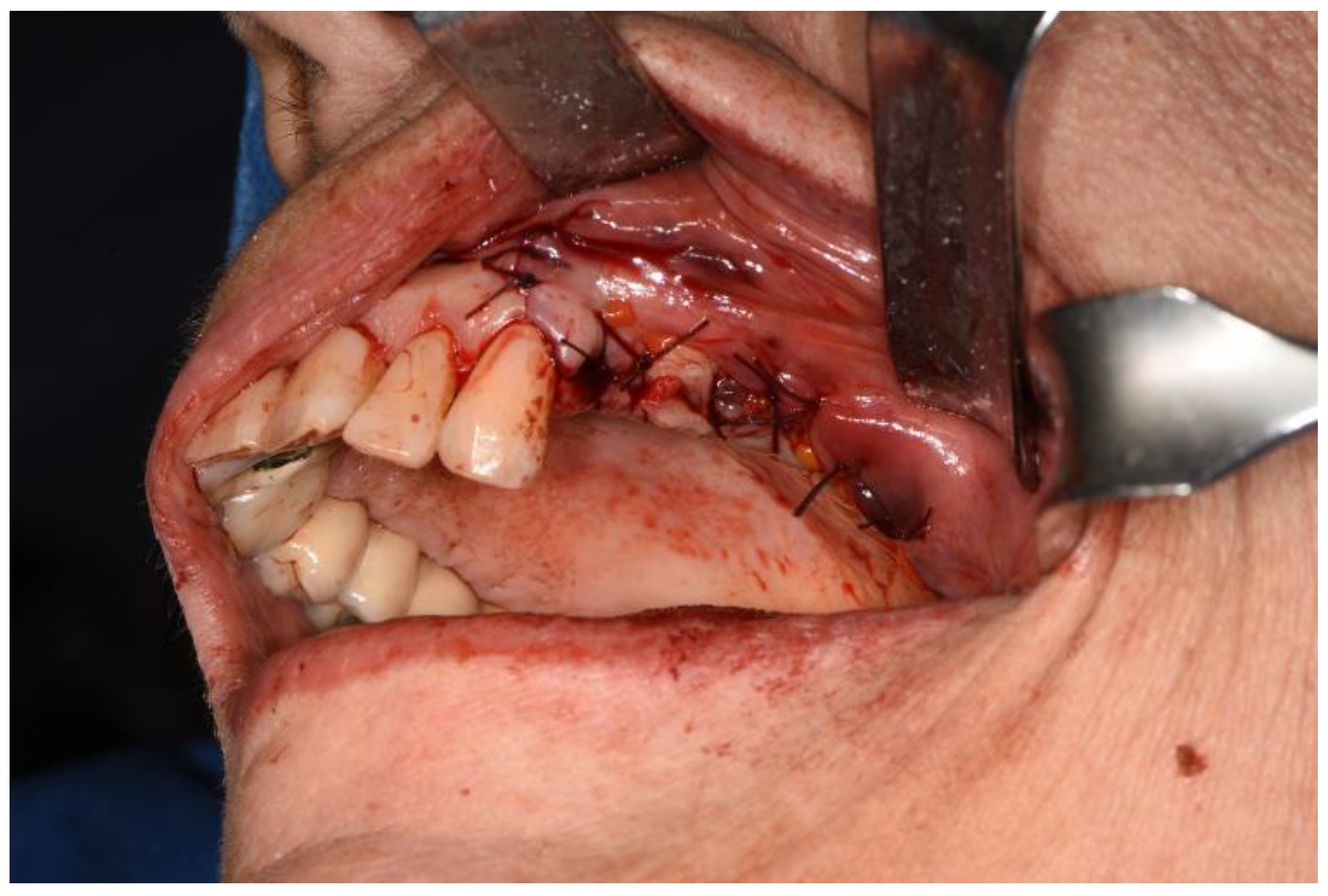 Surgeries 02 00040 g010 550