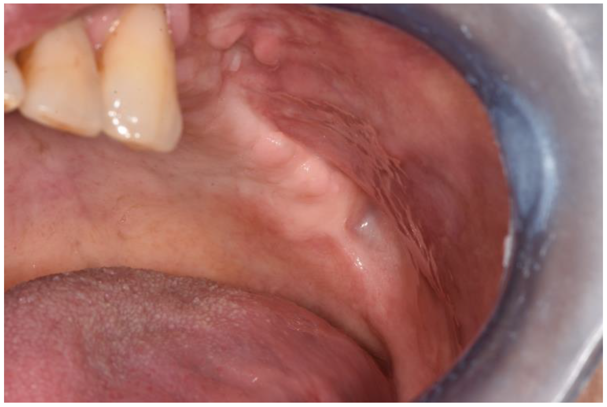 Surgeries 02 00040 g011 550