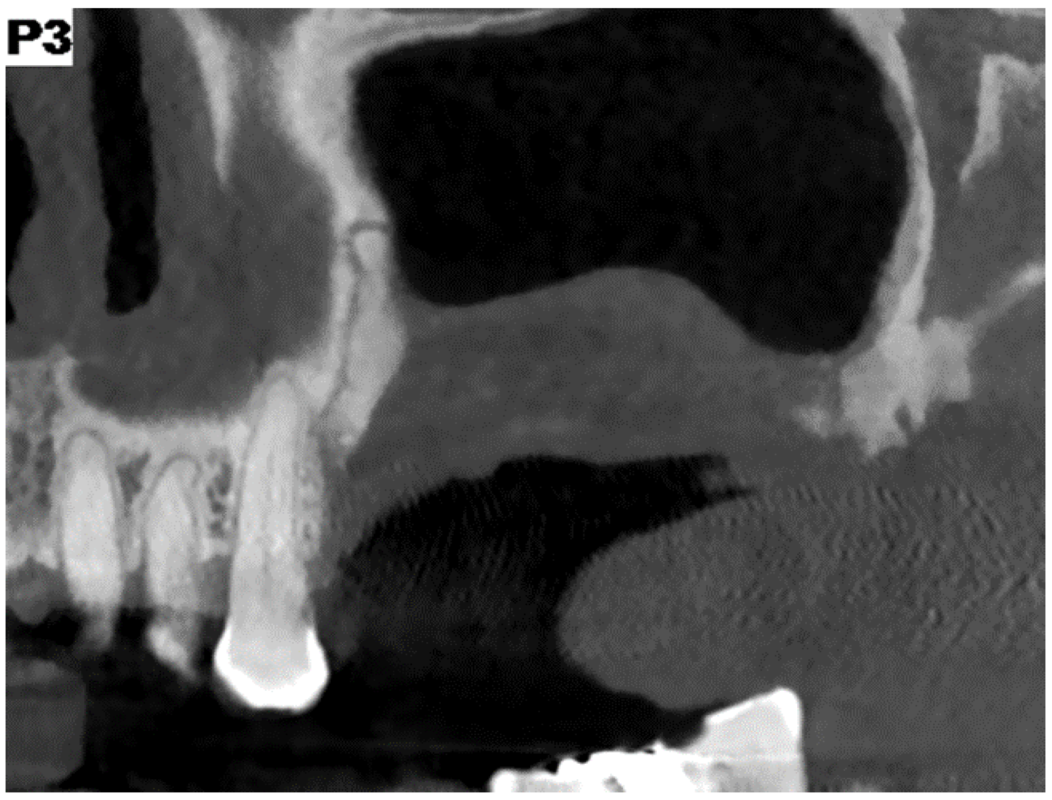 Surgeries 02 00040 g012 550