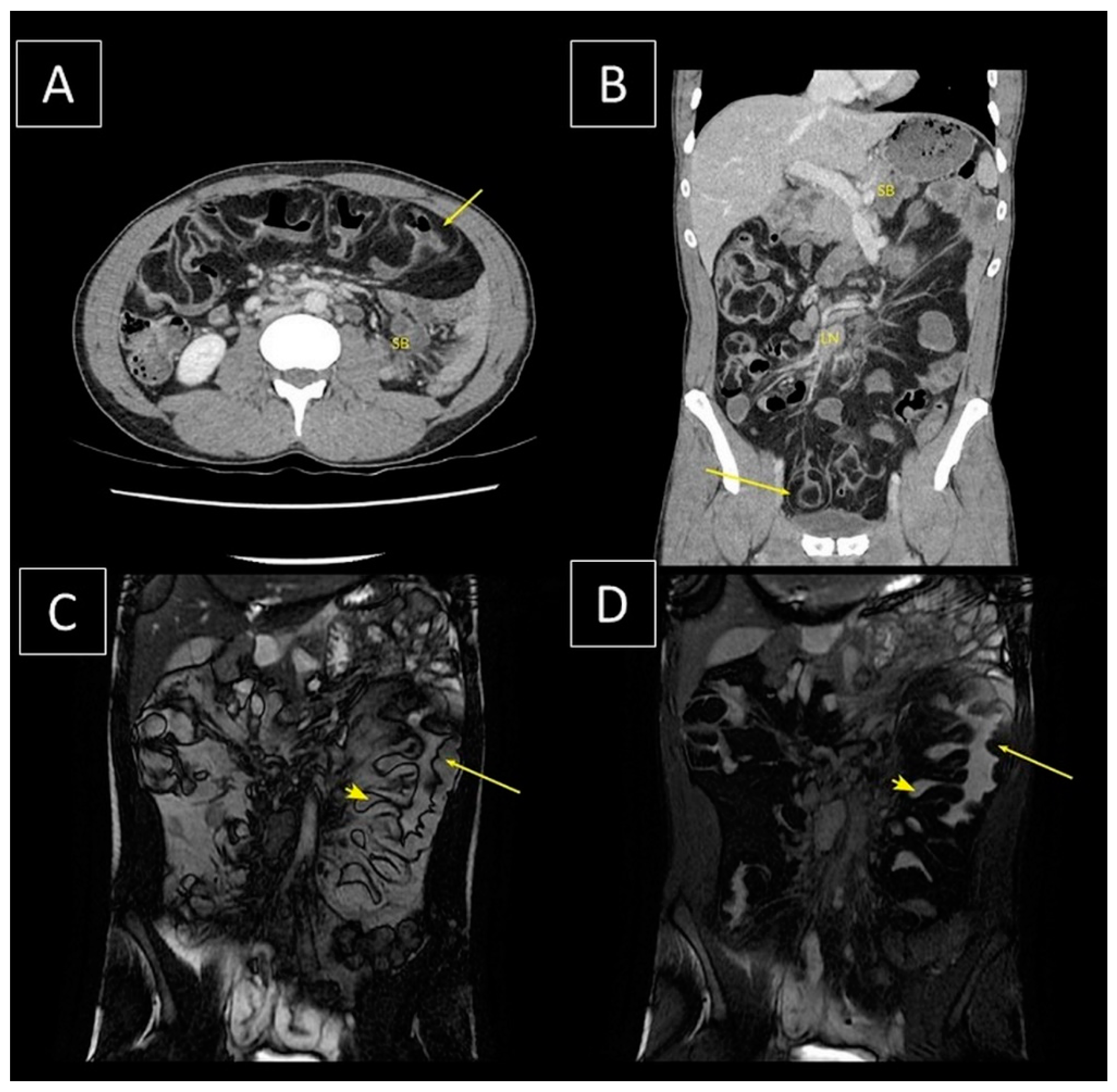 Surgeries 03 00003 g001 Surgeries 03 00003 g001