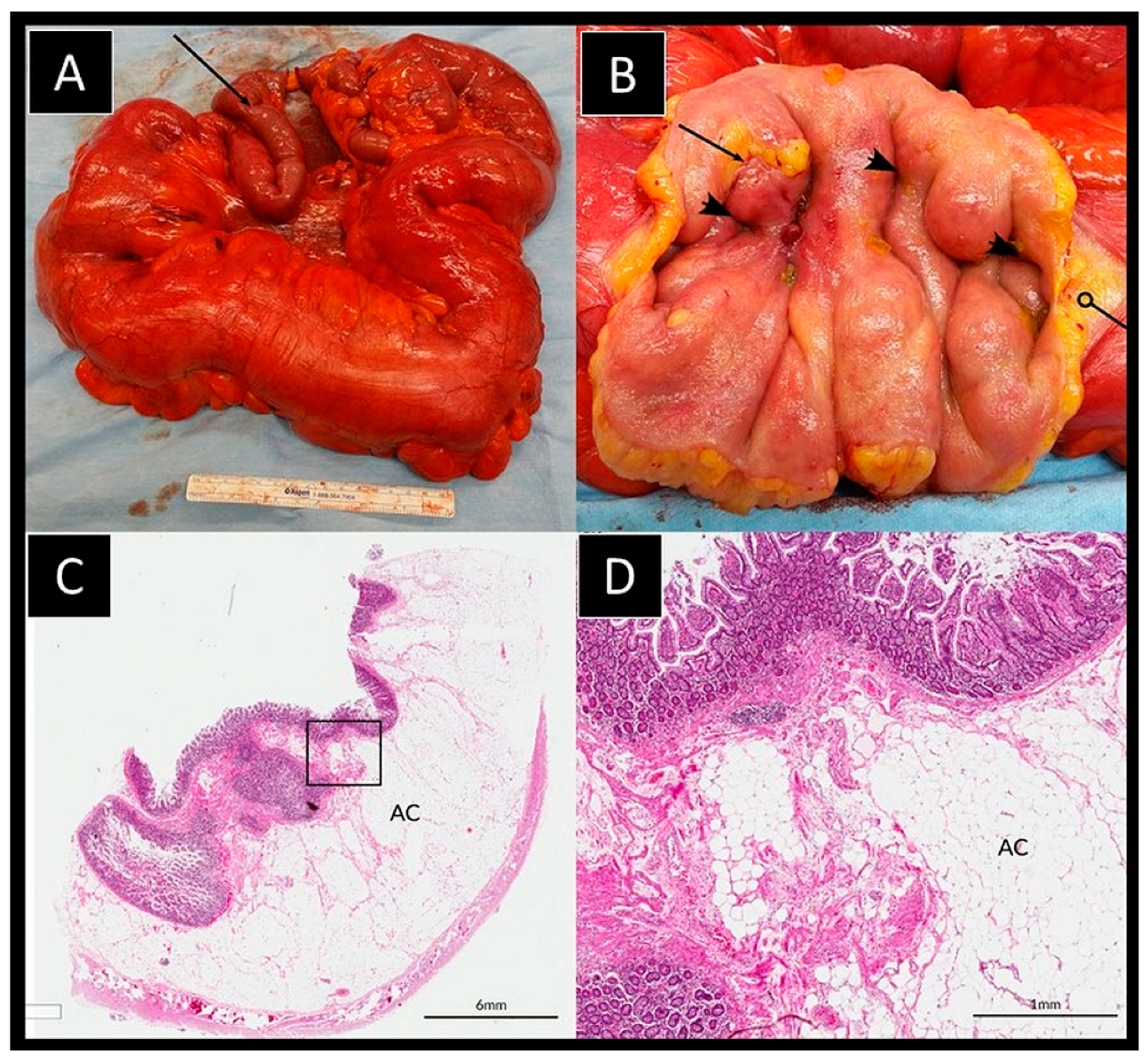 Surgeries 03 00003 g002 Surgeries 03 00003 g002
