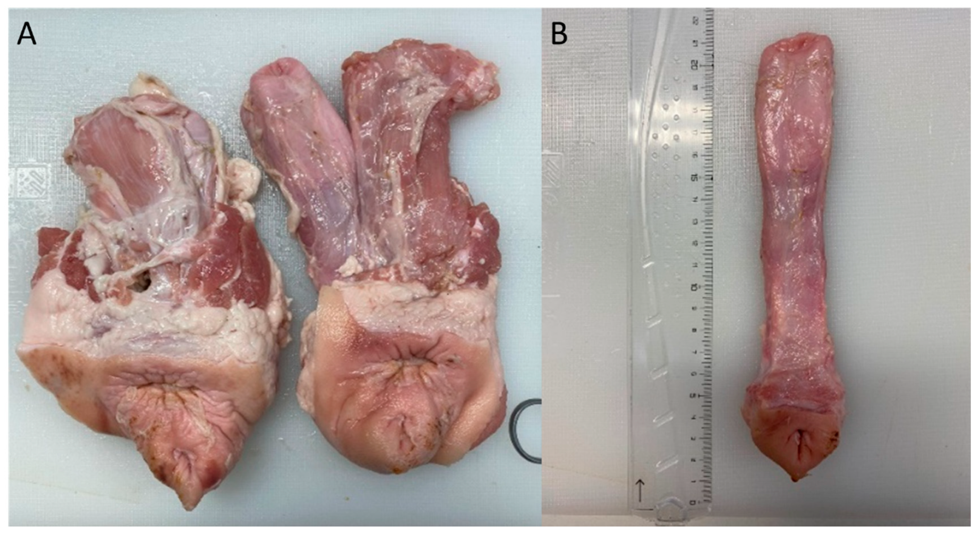 Surgeries 03 00012 g002 550
