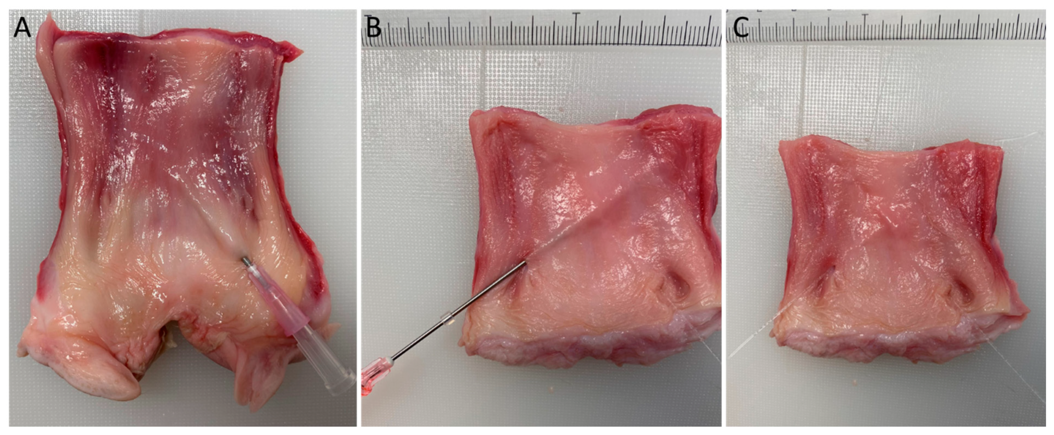 Surgeries 03 00012 g003 550
