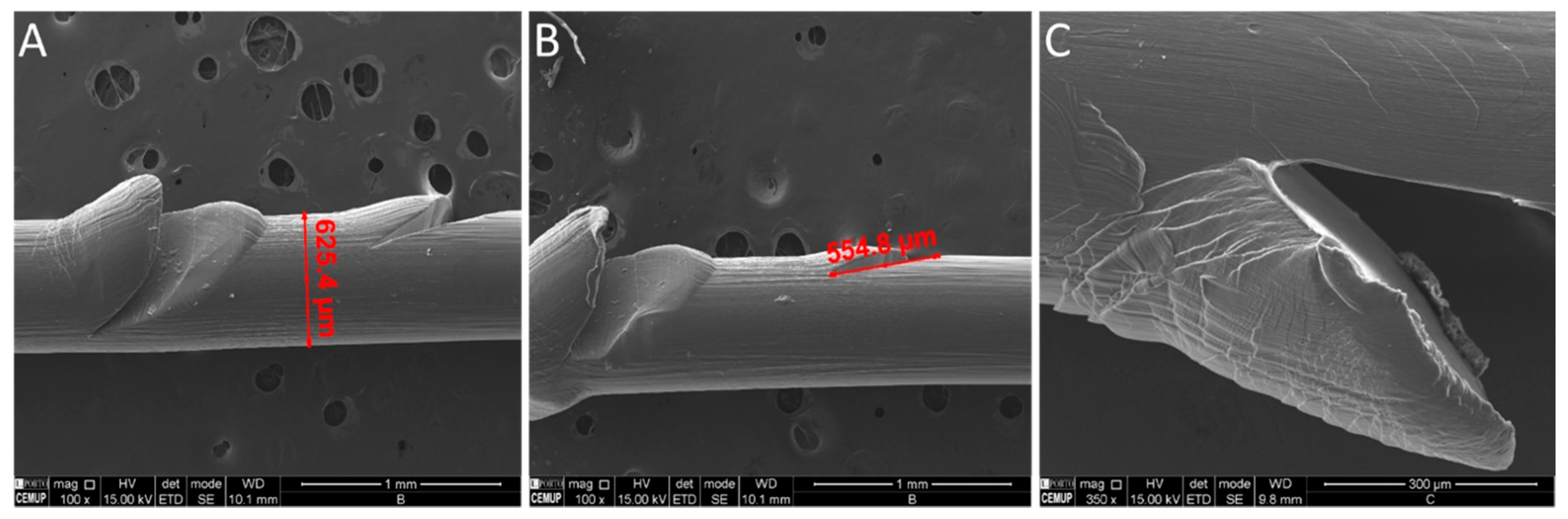 Surgeries 03 00012 g004 550