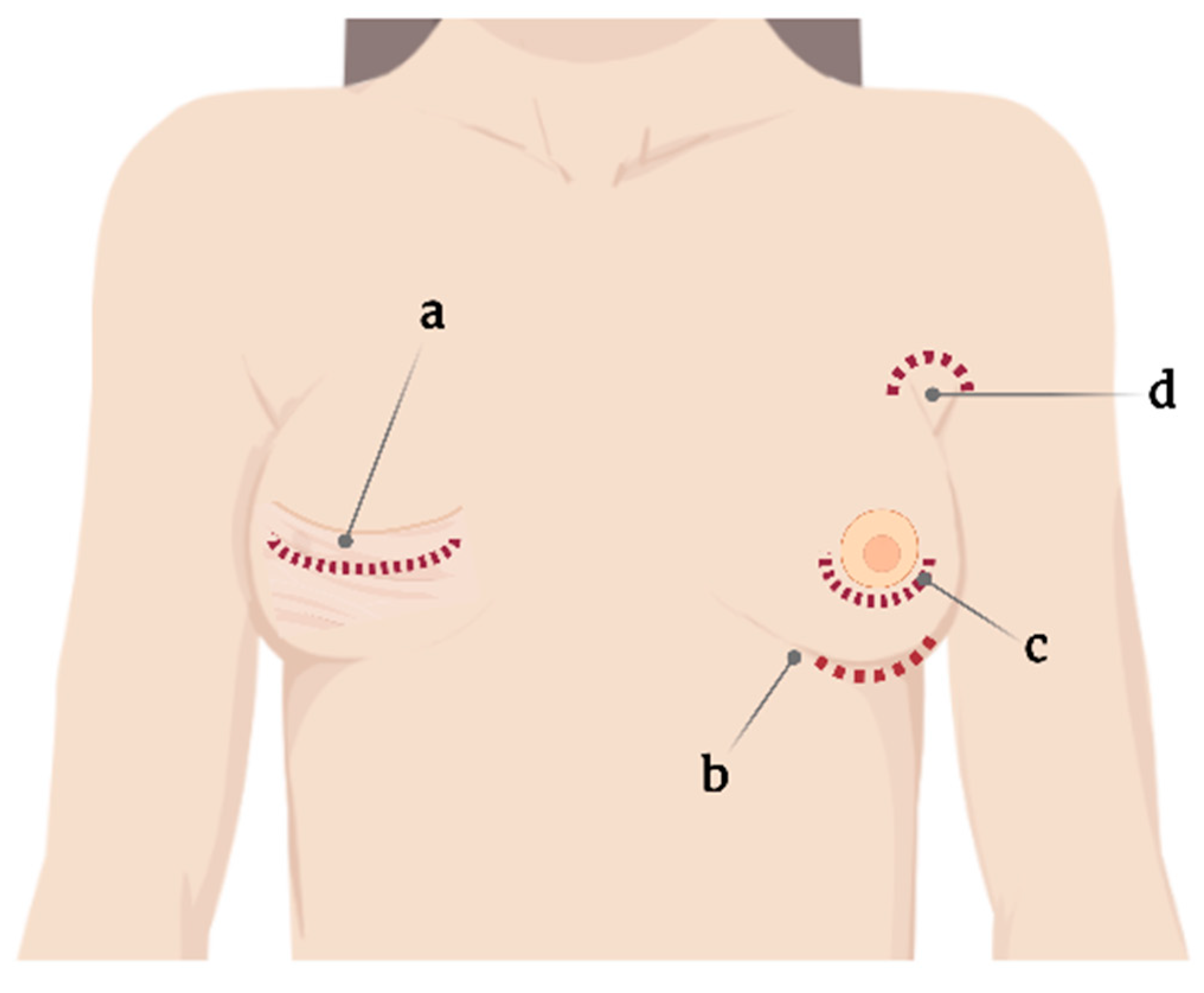 Dr. Andrew Trussler Breast Surgeon