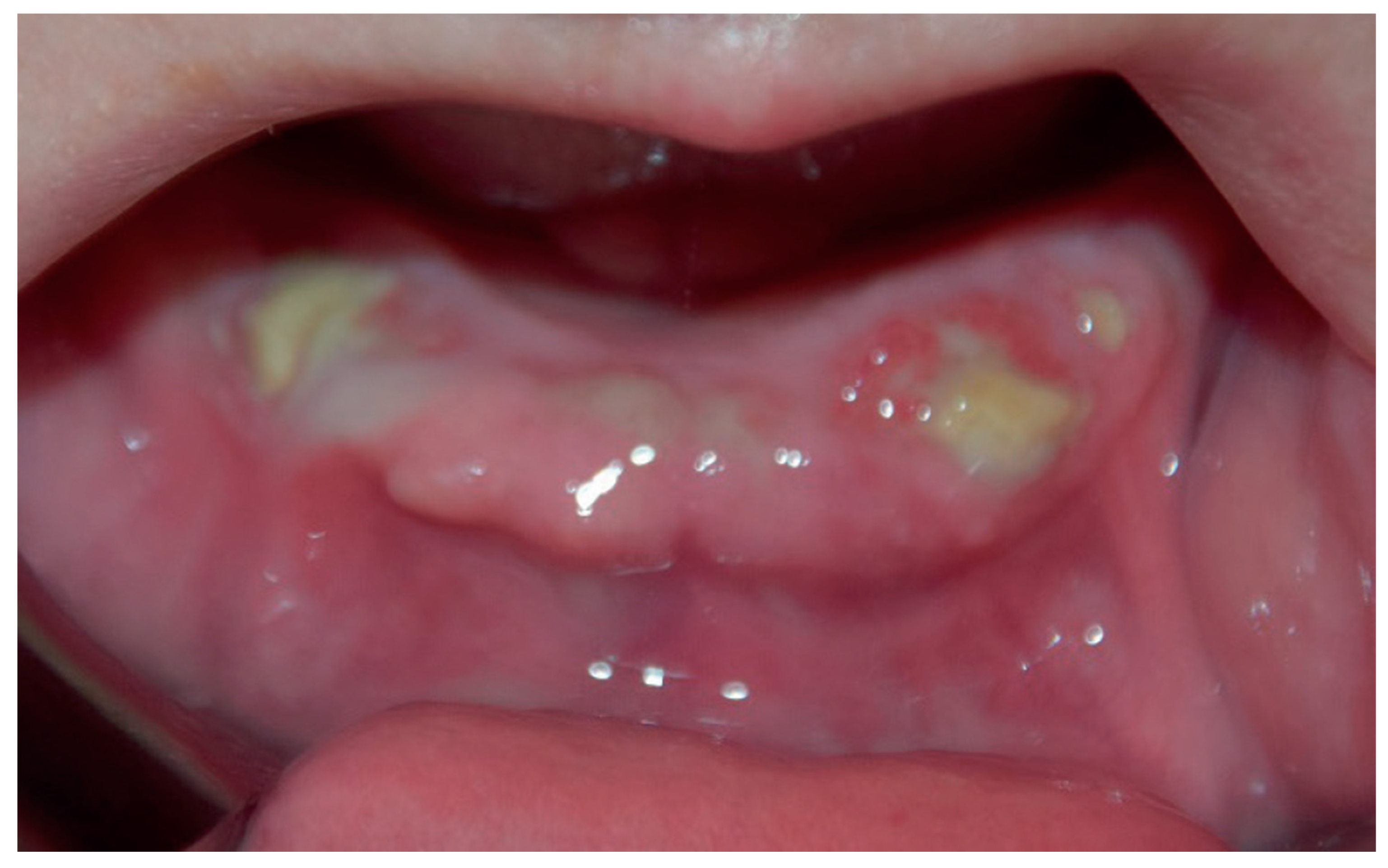 Surgeries 03 00016 g001 Surgeries 03 00016 g001