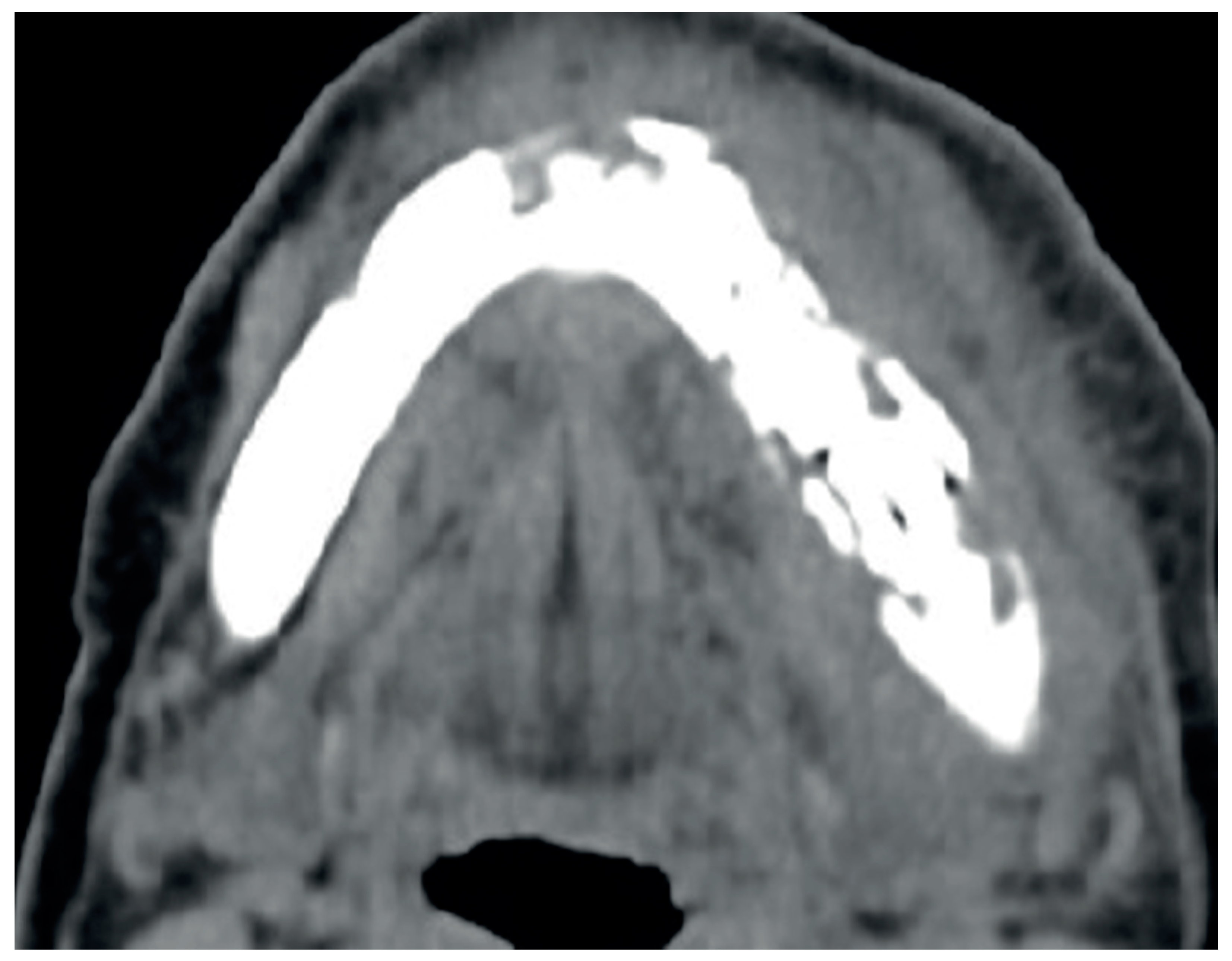 Surgeries 03 00016 g003 Surgeries 03 00016 g003